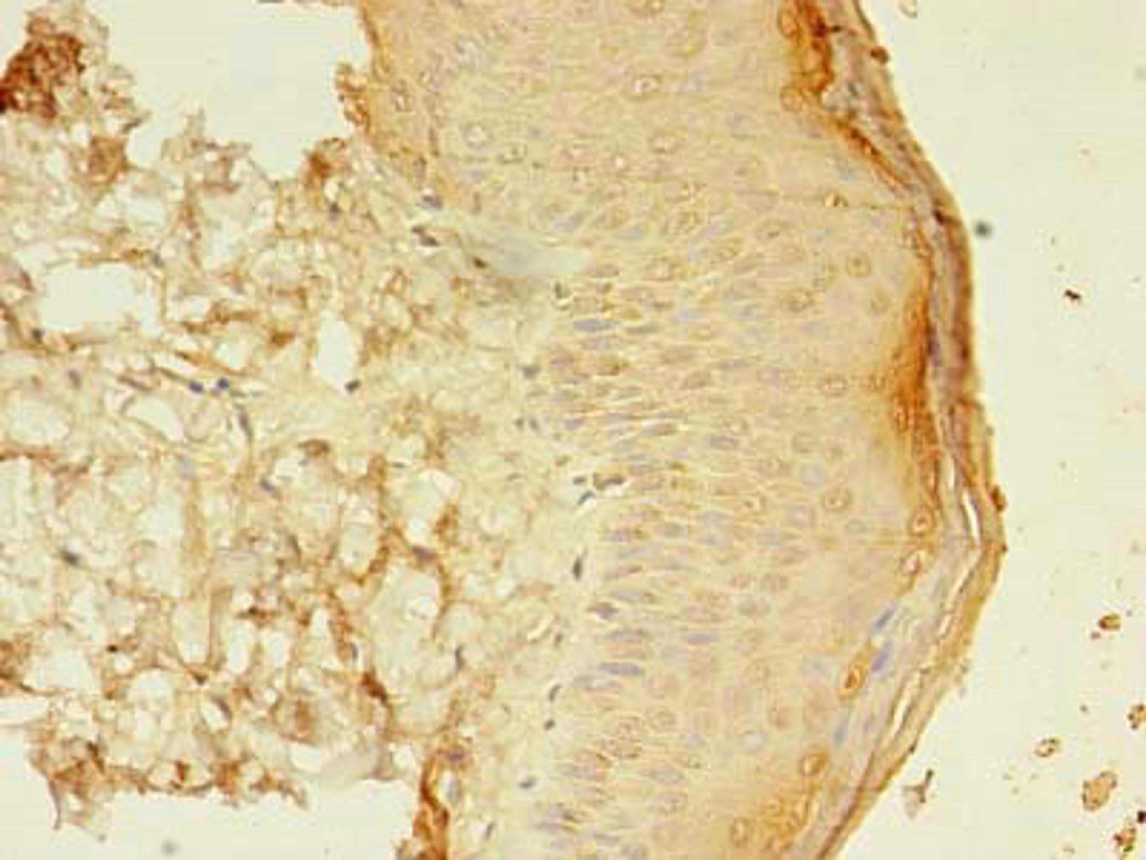 Immunohistochemistry of paraffin-embedded human skin tissue using CSB-PA618998LA01HU at dilution of 1:100