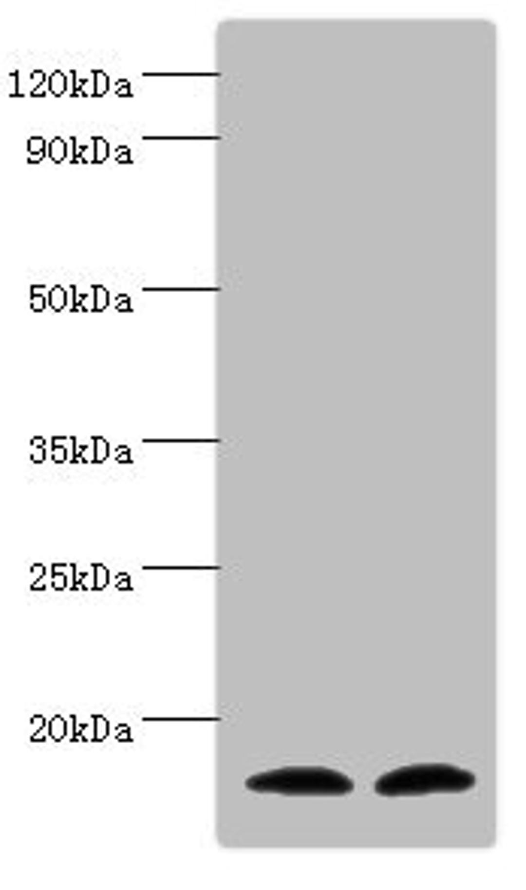 Western blot. All lanes: Protachykinin-1 antibody at 6ug/ml. Lane 1: Mouse liver tissue. Lane 2: 293T whole cell lysate. Secondary. Goat polyclonal to rabbit IgG at 1/10000 dilution. Predicted band size: 16, 14, 12 kDa. Observed band size: 16 kDa. 