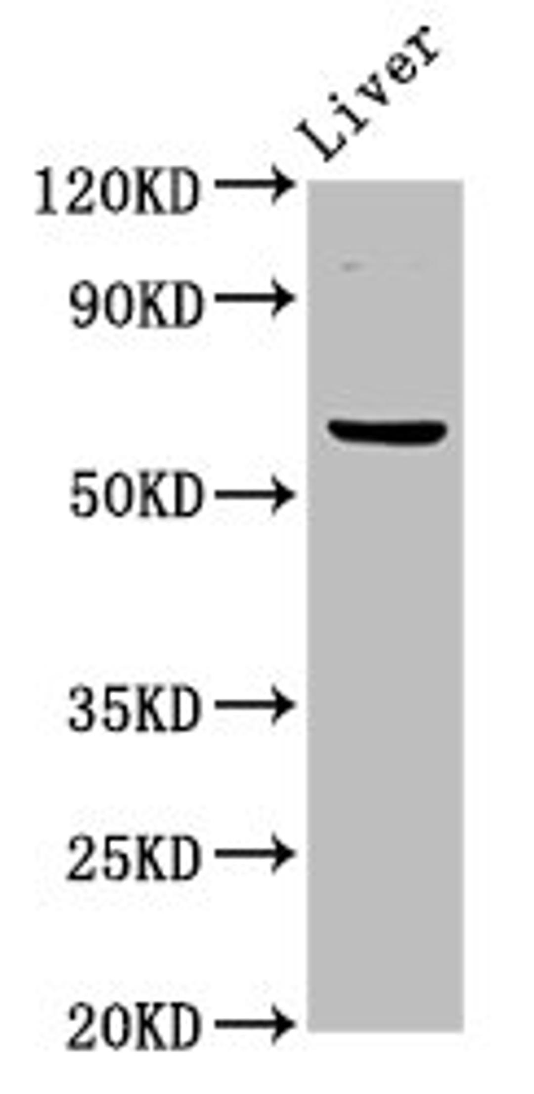 Western Blot. Positive WB detected in: Mouse liver tissue. All lanes: NT5C2 antibody at 3ug/ml. Secondary. Goat polyclonal to rabbit IgG at 1/50000 dilution. Predicted band size: 65, 62 kDa. Observed band size: 65 kDa. 