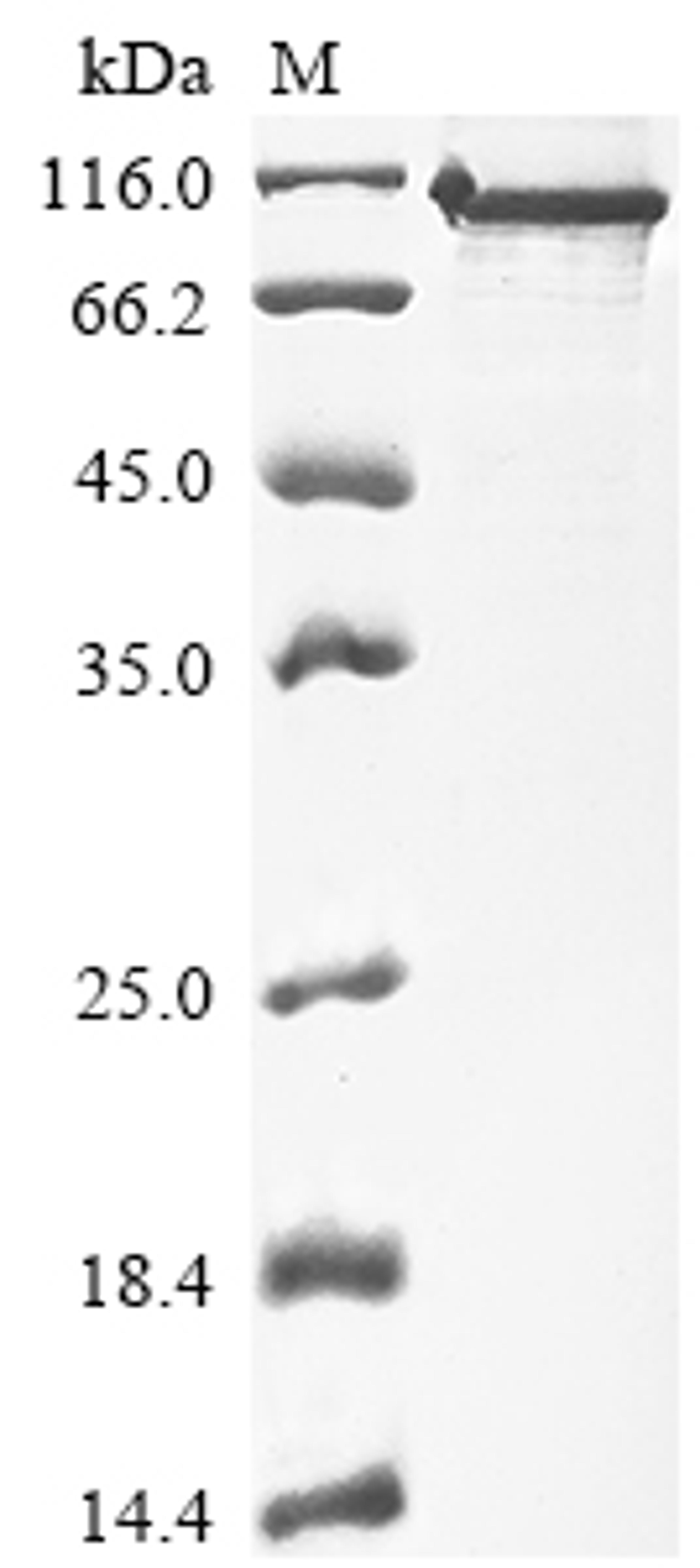 (Tris-Glycine gel) Discontinuous SDS-PAGE (reduced) with 5% enrichment gel and 15% separation gel.