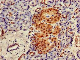 Immunohistochemistry of paraffin-embedded human pancreatic tissue using CSB-PA892477LA01HU at dilution of 1:100