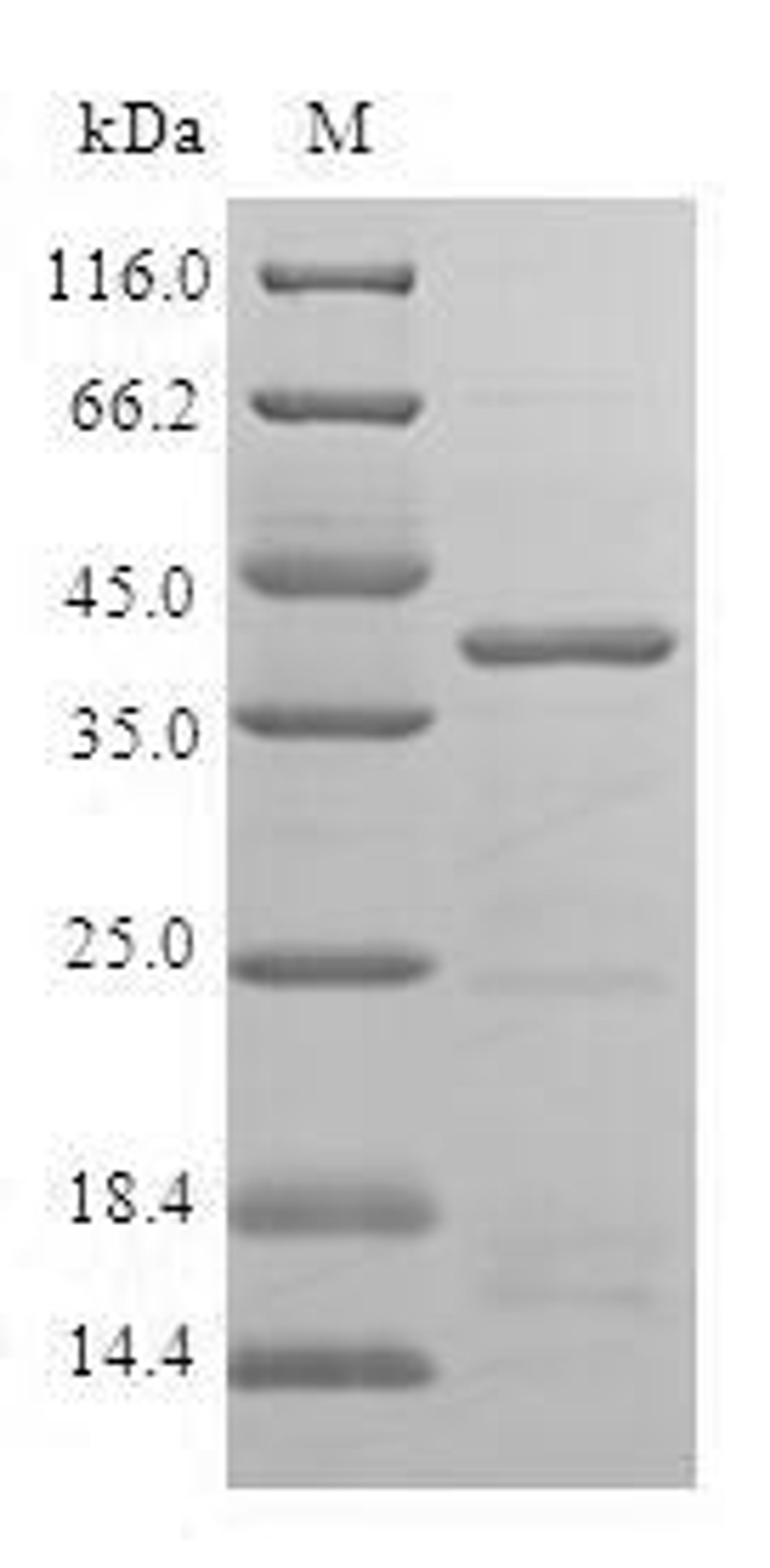 (Tris-Glycine gel) Discontinuous SDS-PAGE (reduced) with 5% enrichment gel and 15% separation gel.