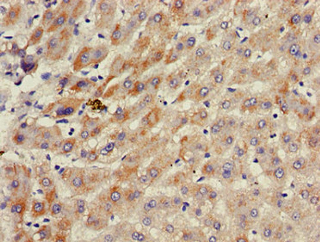 Immunohistochemistry of paraffin-embedded human liver tissue using CSB-PA754597LA01HU at dilution of 1:100