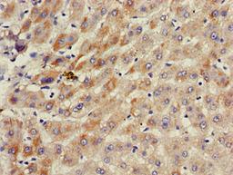 Immunohistochemistry of paraffin-embedded human liver tissue using CSB-PA754597LA01HU at dilution of 1:100