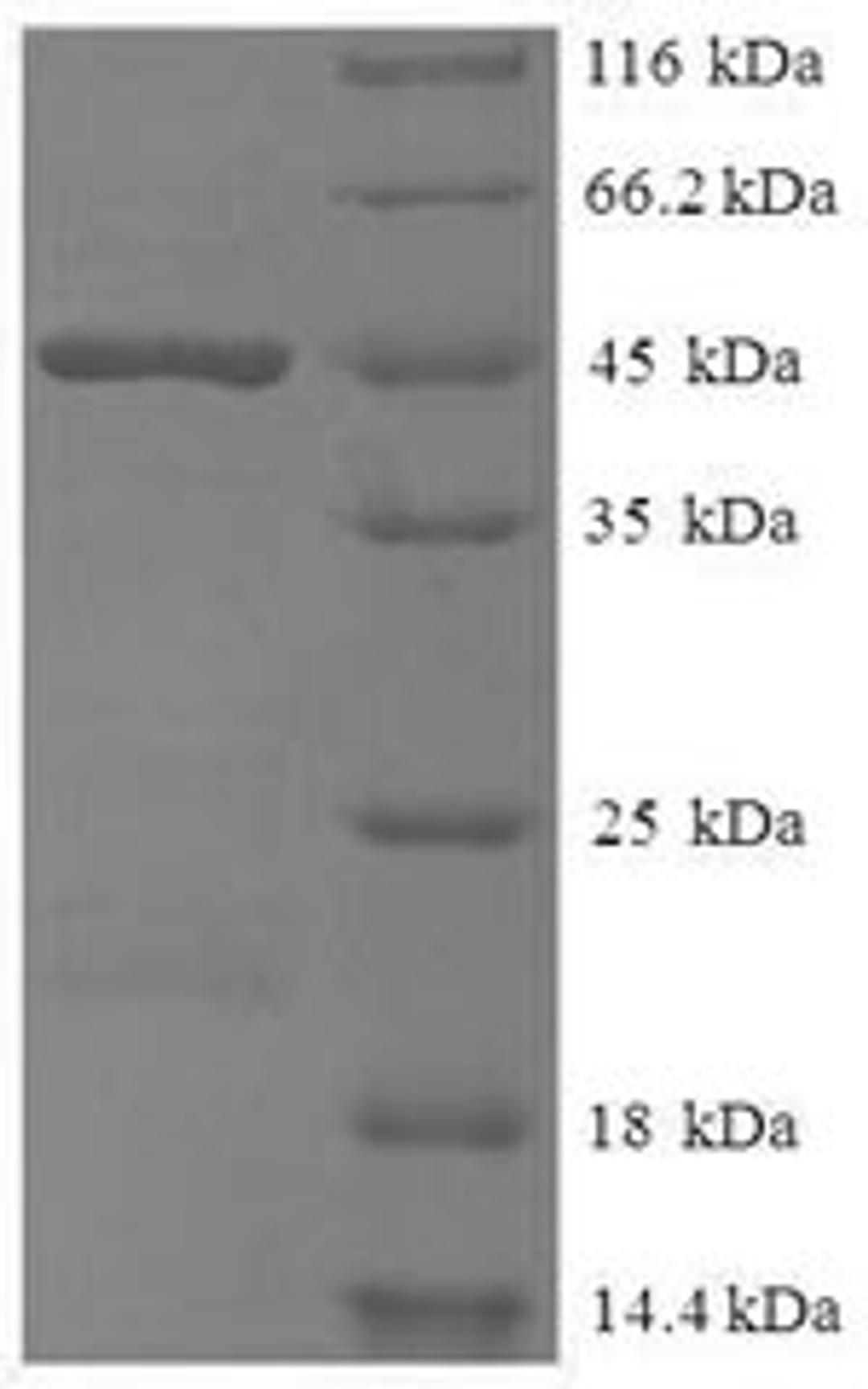 (Tris-Glycine gel) Discontinuous SDS-PAGE (reduced) with 5% enrichment gel and 15% separation gel.