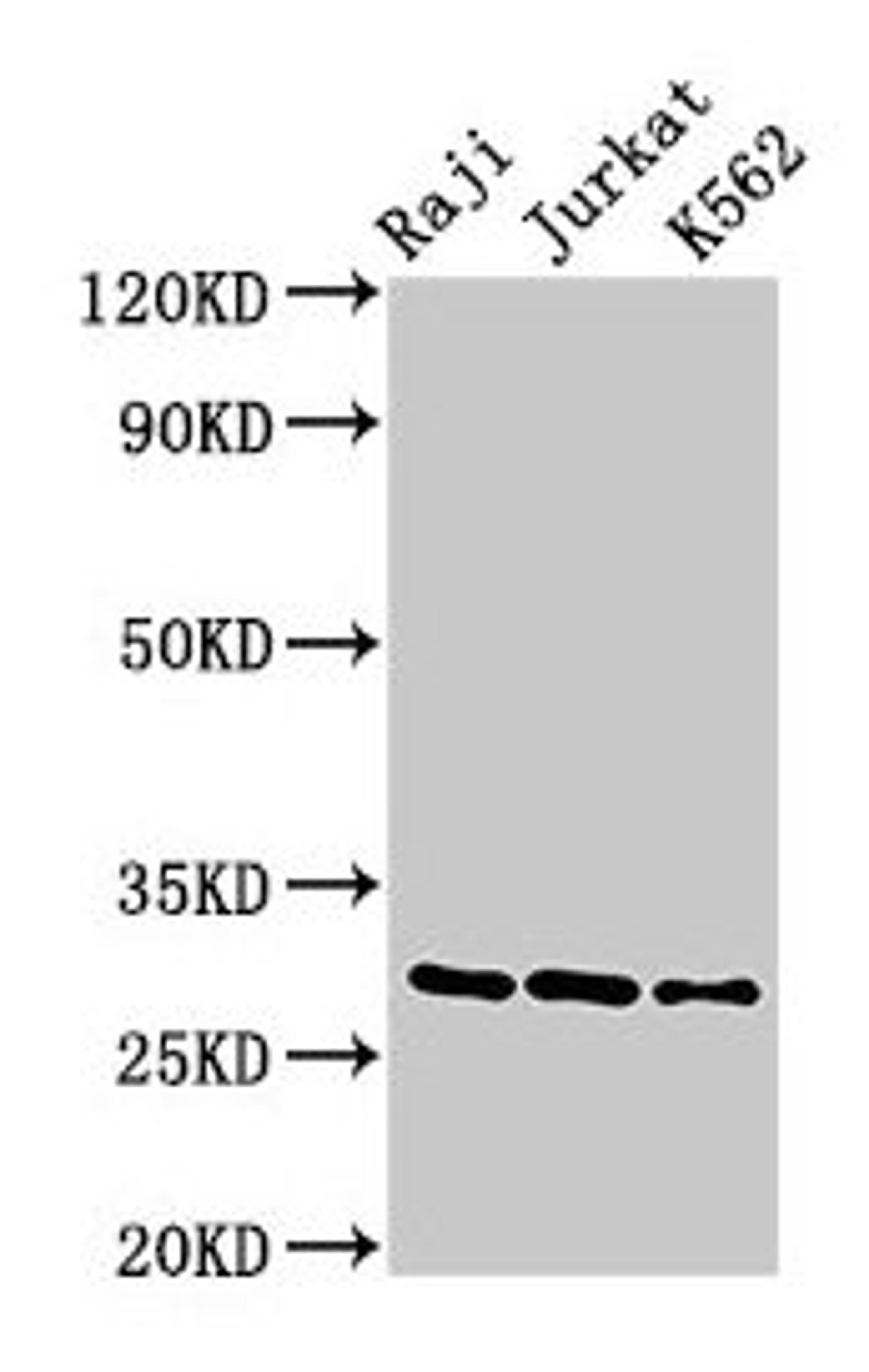 Western Blot. Positive WB detected in: Raji whole cell lysate, Jurkat whole cell lysate, K562 whole cell lysate. All lanes: Gzma antibody at 3µg/ml. Secondary. Goat polyclonal to rabbit IgG at 1/50000 dilution. Predicted band size: 29 kDa. Observed band size: 29 kDa