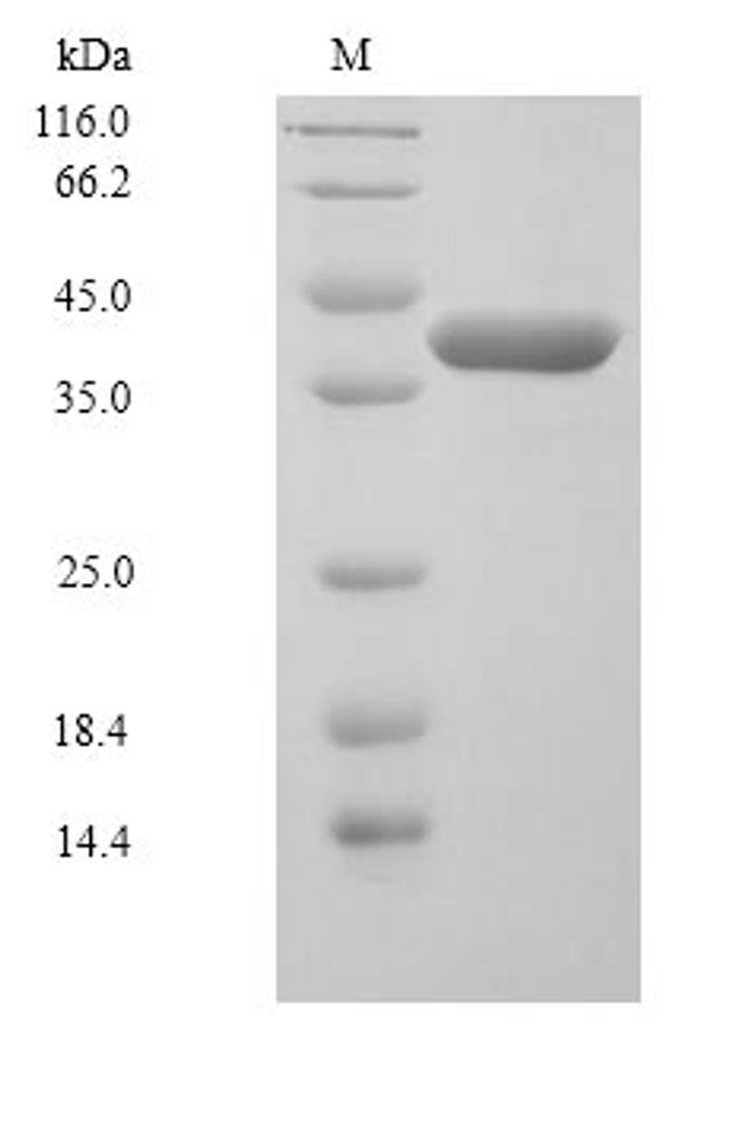 (Tris-Glycine gel) Discontinuous SDS-PAGE (reduced) with 5% enrichment gel and 15% separation gel.
