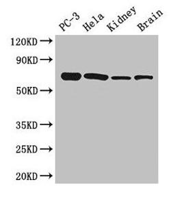 Western Blot. Positive WB detected in: PC-3 whole cell lysate, Hela whole cell lysate, Mouse kidney tissue, Mouse brain tissue. All lanes: GPI antibody at 2.7µg/ml. Secondary. Goat polyclonal to rabbit IgG at 1/50000 dilution. Predicted band size: 64, 65 kDa. Observed band size: 64 kDa