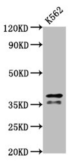 Western Blot. Positive WB detected in: K562 whole cell lysate. All lanes: HNRNPAB antibody at 2.7µg/ml. Secondary. Goat polyclonal to rabbit IgG at 1/50000 dilution. Predicted band size: 37, 36, 31 kDa. Observed band size: 37, 36 kDa