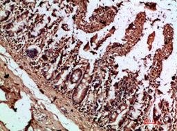 Immunohistochemical analysis of paraffin-embedded human-colon, antibody was diluted at 1:200