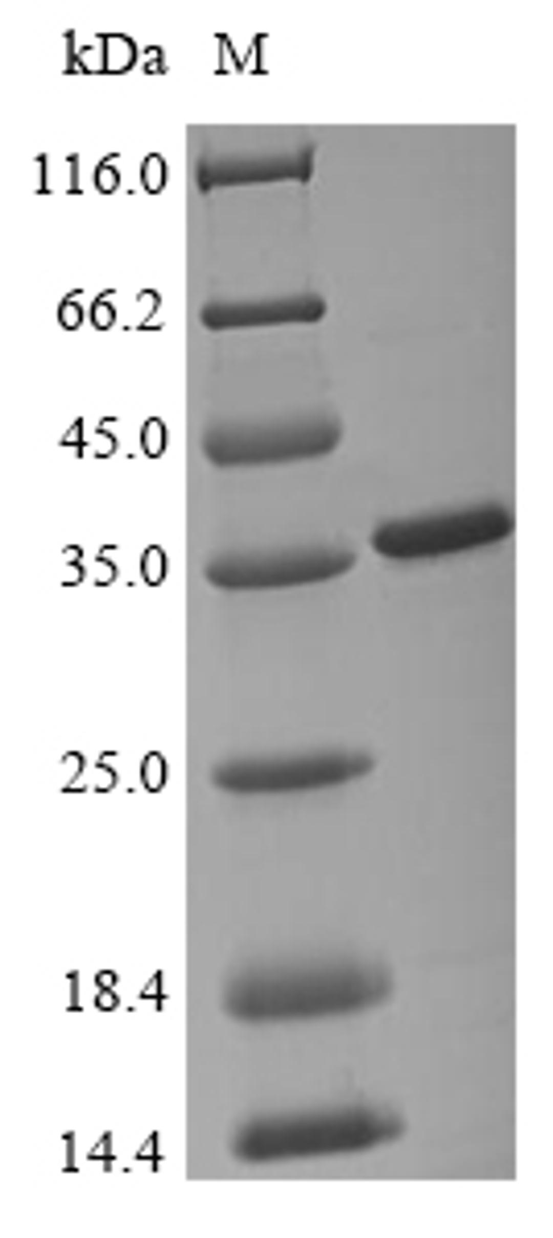 (Tris-Glycine gel) Discontinuous SDS-PAGE (reduced) with 5% enrichment gel and 15% separation gel.