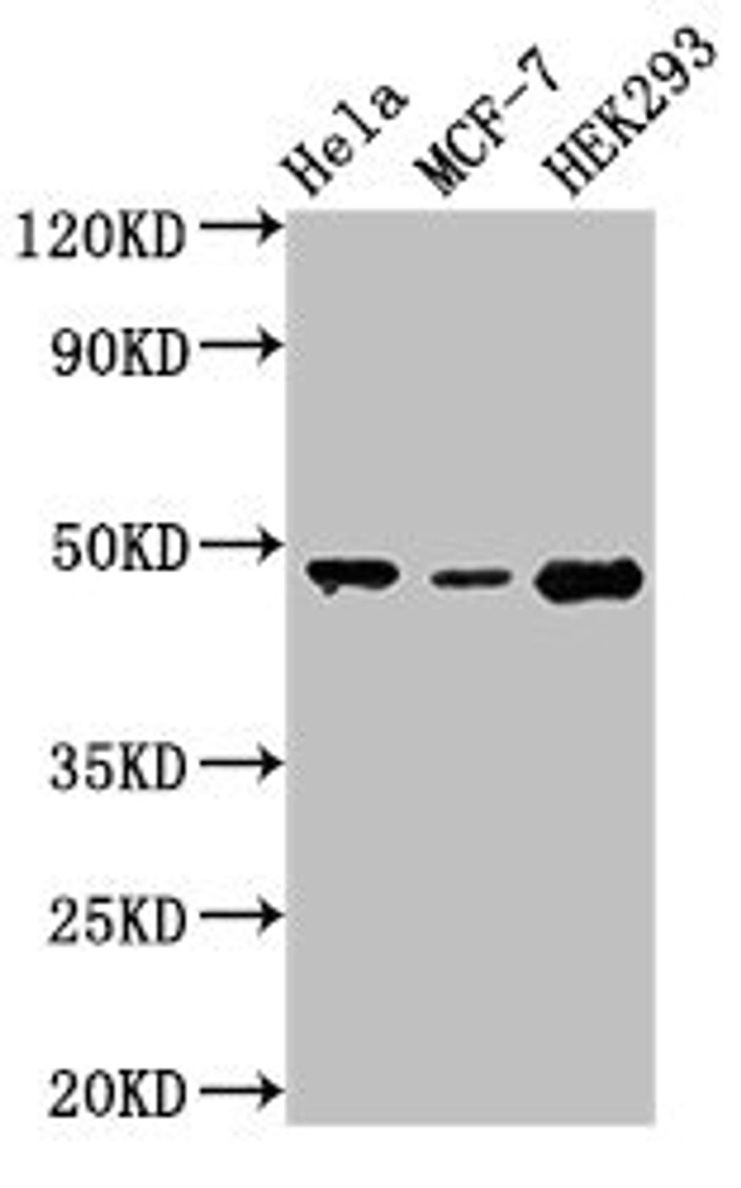 Western Blot. Positive WB detected in: Hela whole cell lysate, MCF-7 whole cell lysate, HEK293 whole cell lysate. All lanes: PACSIN3 antibody at 2.8µg/ml. Secondary. Goat polyclonal to rabbit IgG at 1/50000 dilution. Predicted band size: 49 kDa. Observed band size: 49 kDa