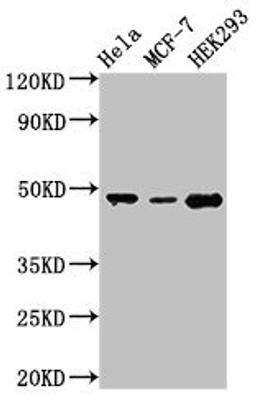 Western Blot. Positive WB detected in: Hela whole cell lysate, MCF-7 whole cell lysate, HEK293 whole cell lysate. All lanes: PACSIN3 antibody at 2.8µg/ml. Secondary. Goat polyclonal to rabbit IgG at 1/50000 dilution. Predicted band size: 49 kDa. Observed band size: 49 kDa
