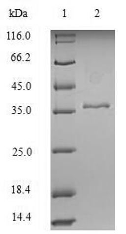 (Tris-Glycine gel) Discontinuous SDS-PAGE (reduced) with 5% enrichment gel and 15% separation gel.