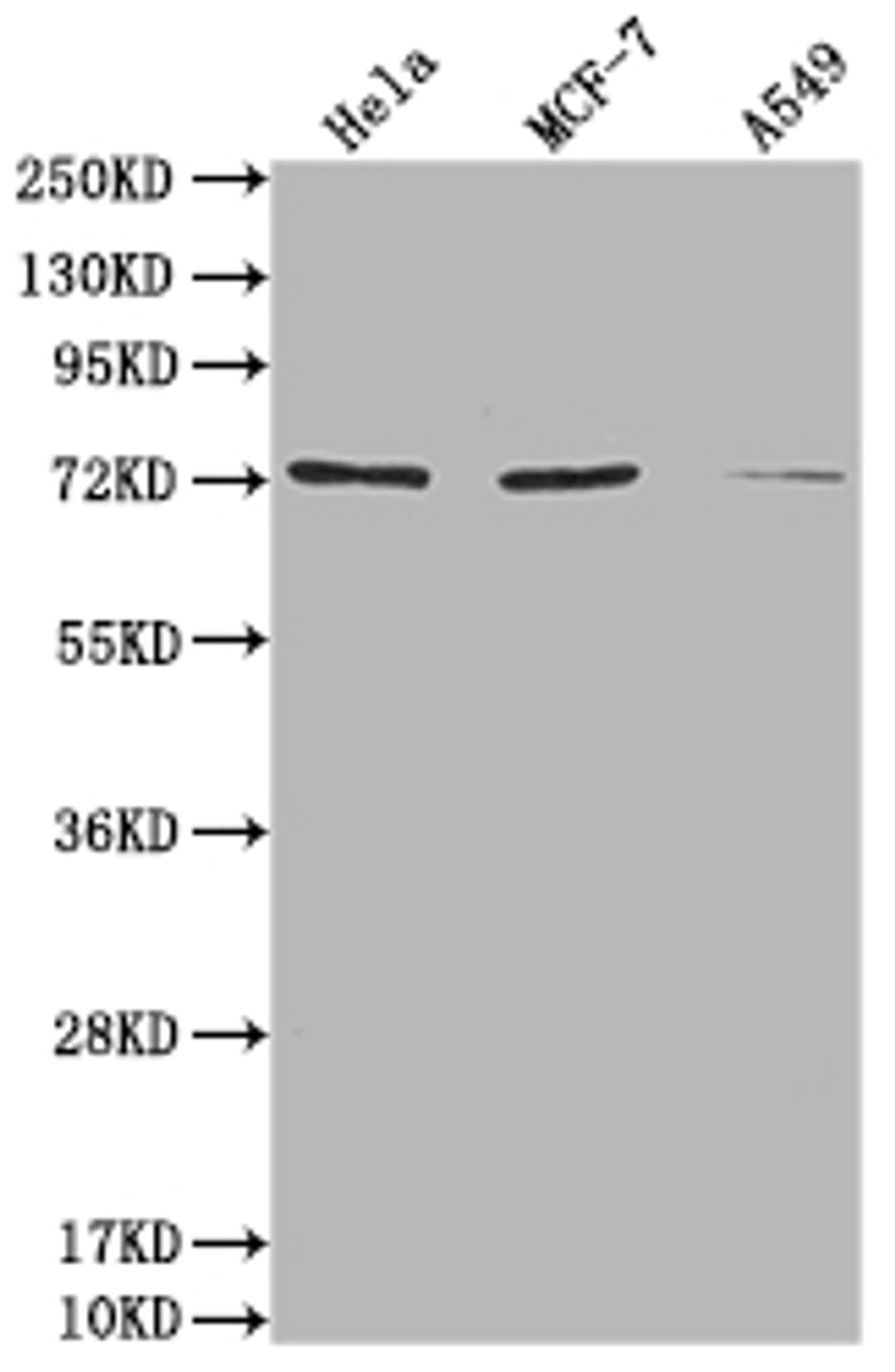 Western Blot. Positive WB detected in: Hela whole cell lysate, MCF-7 whole cell lysate, A549 whole cell lysate. All lanes: SAMHD1 antibody at 1:2000. Secondary. Goat polyclonal to rabbit IgG at 1/50000 dilution. Predicted band size: 73, 64, 69 kDa. Observed band size: 73 kDa. 