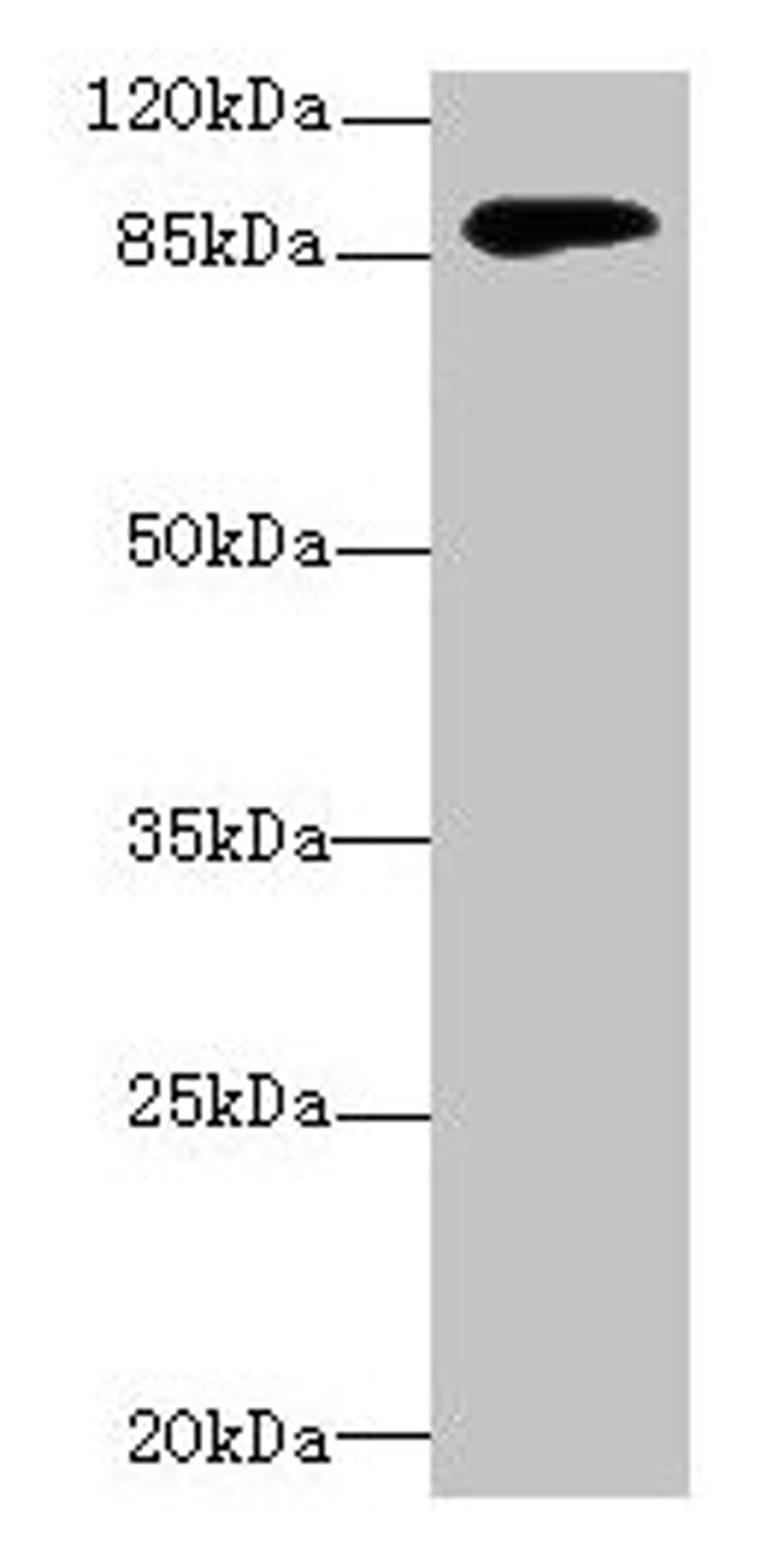 Western blot. All lanes: DGKG antibody at 4µg/ml + Mouse brain tissue. Secondary. Goat polyclonal to rabbit IgG at 1/10000 dilution. Predicted band size: 90, 87, 85 kDa. Observed band size: 90 kDa