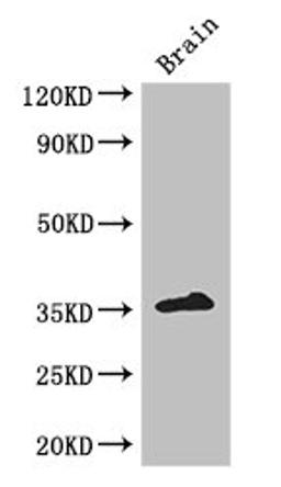 Western Blot. Positive WB detected in: Mouse brain tissue. All lanes: ZFP42 antibody at 3ug/ml. Secondary. Goat polyclonal to rabbit IgG at 1/50000 dilution. Predicted band size: 35 kDa. Observed band size: 35 kDa. 