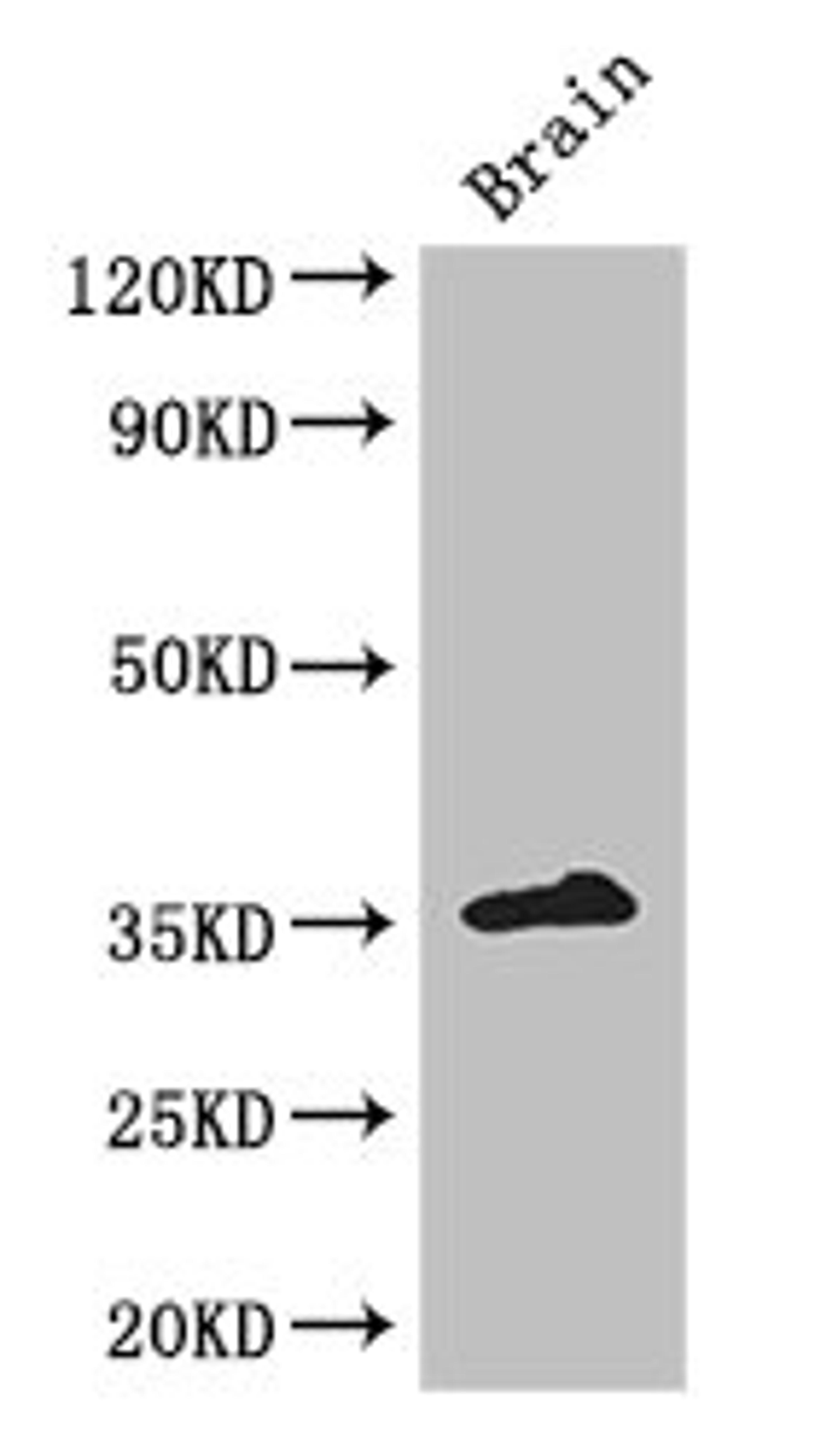Western Blot. Positive WB detected in: Mouse brain tissue. All lanes: ZFP42 antibody at 3ug/ml. Secondary. Goat polyclonal to rabbit IgG at 1/50000 dilution. Predicted band size: 35 kDa. Observed band size: 35 kDa. 