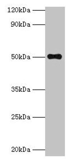 Western blot. All lanes: TMLHE antibody at 2µg/ml + MCF-7 whole cell lysate. Secondary. Goat polyclonal to rabbit IgG at 1/10000 dilution. Predicted band size: 50, 47, 39, 45, 43, 42, 51 kDa. Observed band size: 50 kDa