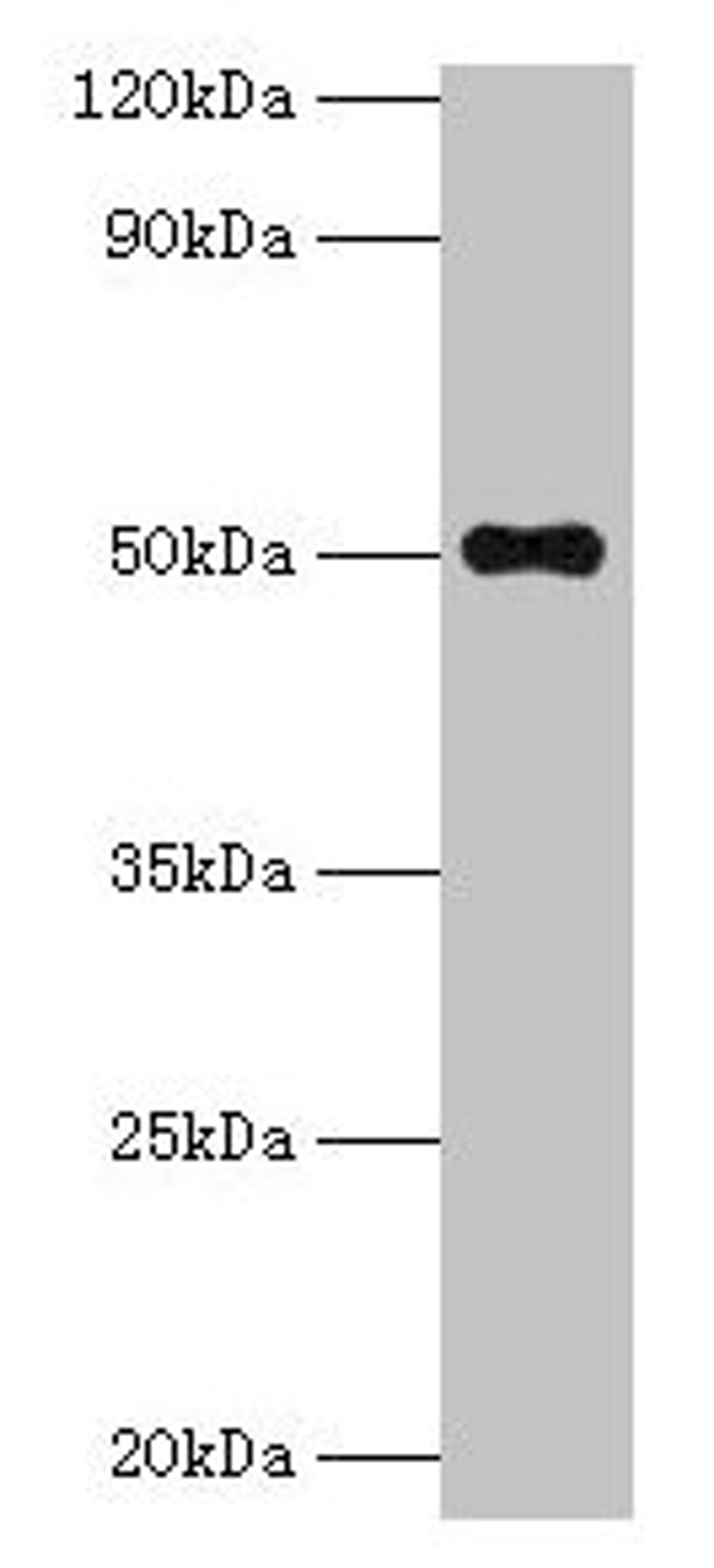 Western blot. All lanes: TMLHE antibody at 2µg/ml + MCF-7 whole cell lysate. Secondary. Goat polyclonal to rabbit IgG at 1/10000 dilution. Predicted band size: 50, 47, 39, 45, 43, 42, 51 kDa. Observed band size: 50 kDa