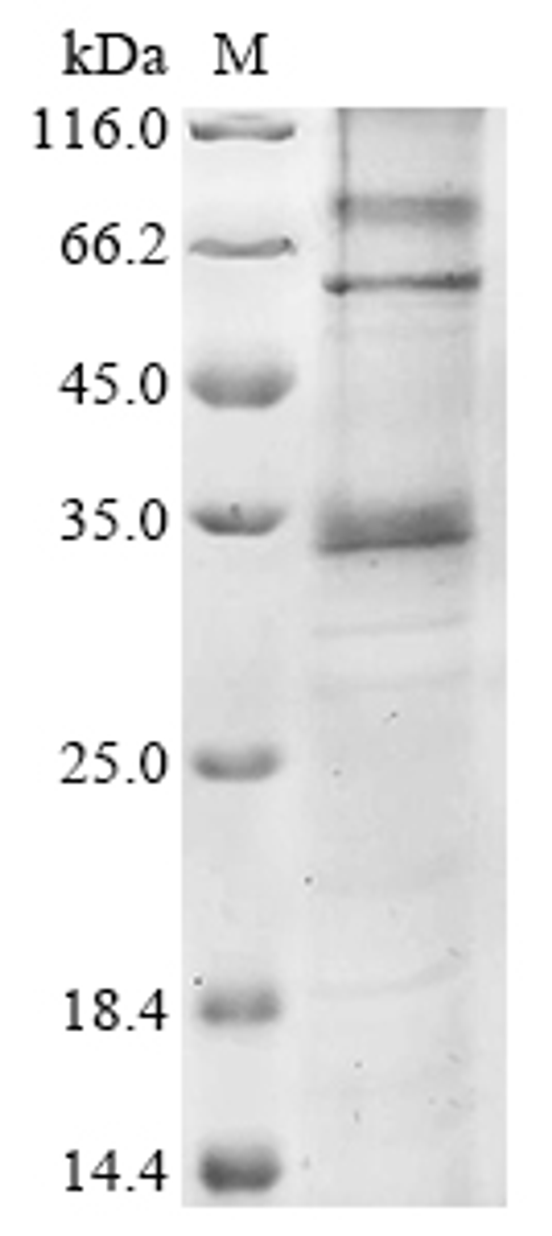 (Tris-Glycine gel) Discontinuous SDS-PAGE (reduced) with 5% enrichment gel and 15% separation gel.