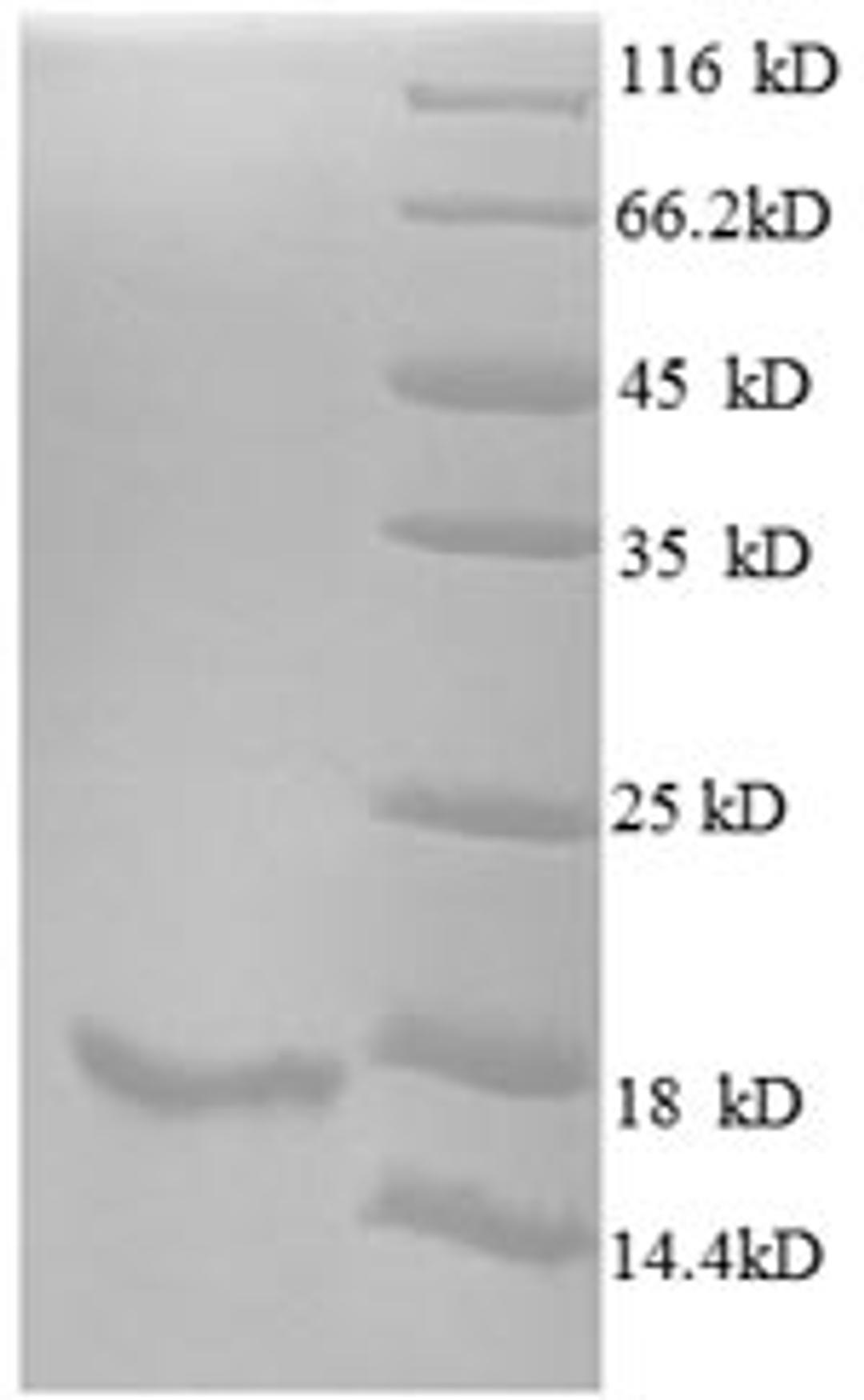 (Tris-Glycine gel) Discontinuous SDS-PAGE (reduced) with 5% enrichment gel and 15% separation gel.
