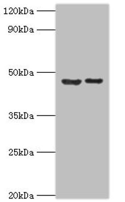 Western blot. All lanes: Histone-lysine N-methyltransferase SUV39H2 antibody at 0.32ug/ml. Lane 1: HepG2 whole cell lysate. Lane 2: Hela whole cell lysate. Secondary. Goat polyclonal to rabbit IgG at 1/10000 dilution. Predicted band size: 47, 40, 27 kDa. Observed band size: 47 kDa. 