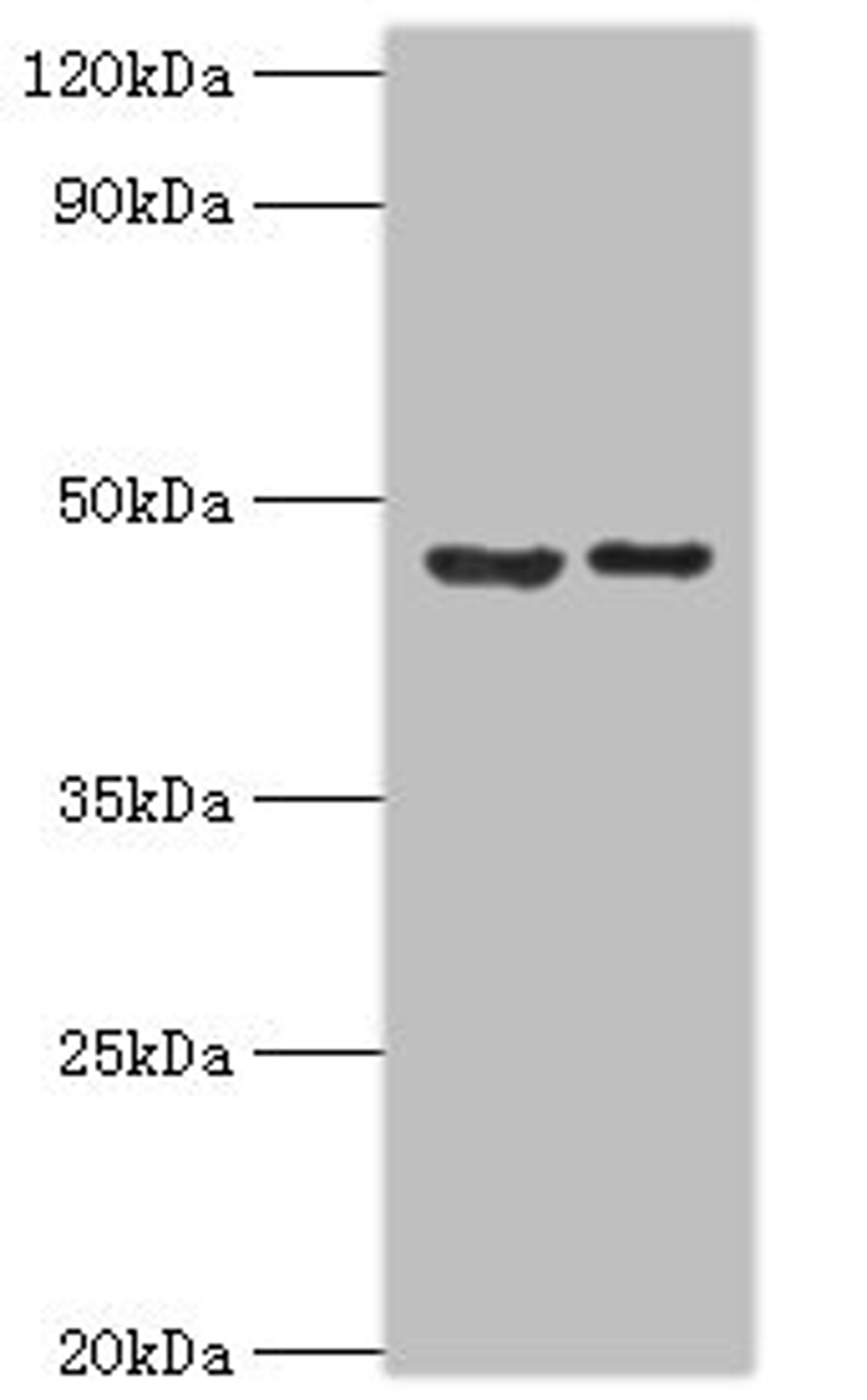 Western blot. All lanes: Histone-lysine N-methyltransferase SUV39H2 antibody at 0.32ug/ml. Lane 1: HepG2 whole cell lysate. Lane 2: Hela whole cell lysate. Secondary. Goat polyclonal to rabbit IgG at 1/10000 dilution. Predicted band size: 47, 40, 27 kDa. Observed band size: 47 kDa.