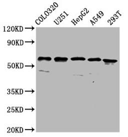 Western Blot. Positive WB detected in: Colo320 whole cell lysate, U251 whole cell lysate, HepG2 whole cell lysate, A549 whole cell lysate, 293T whole cell lysate. All lanes: CLCC1 antibody at 3.7µg/ml. Secondary. Goat polyclonal to rabbit IgG at 1/50000 dilution. Predicted band size: 63, 57, 48, 40 kDa. Observed band size: 63 kDa