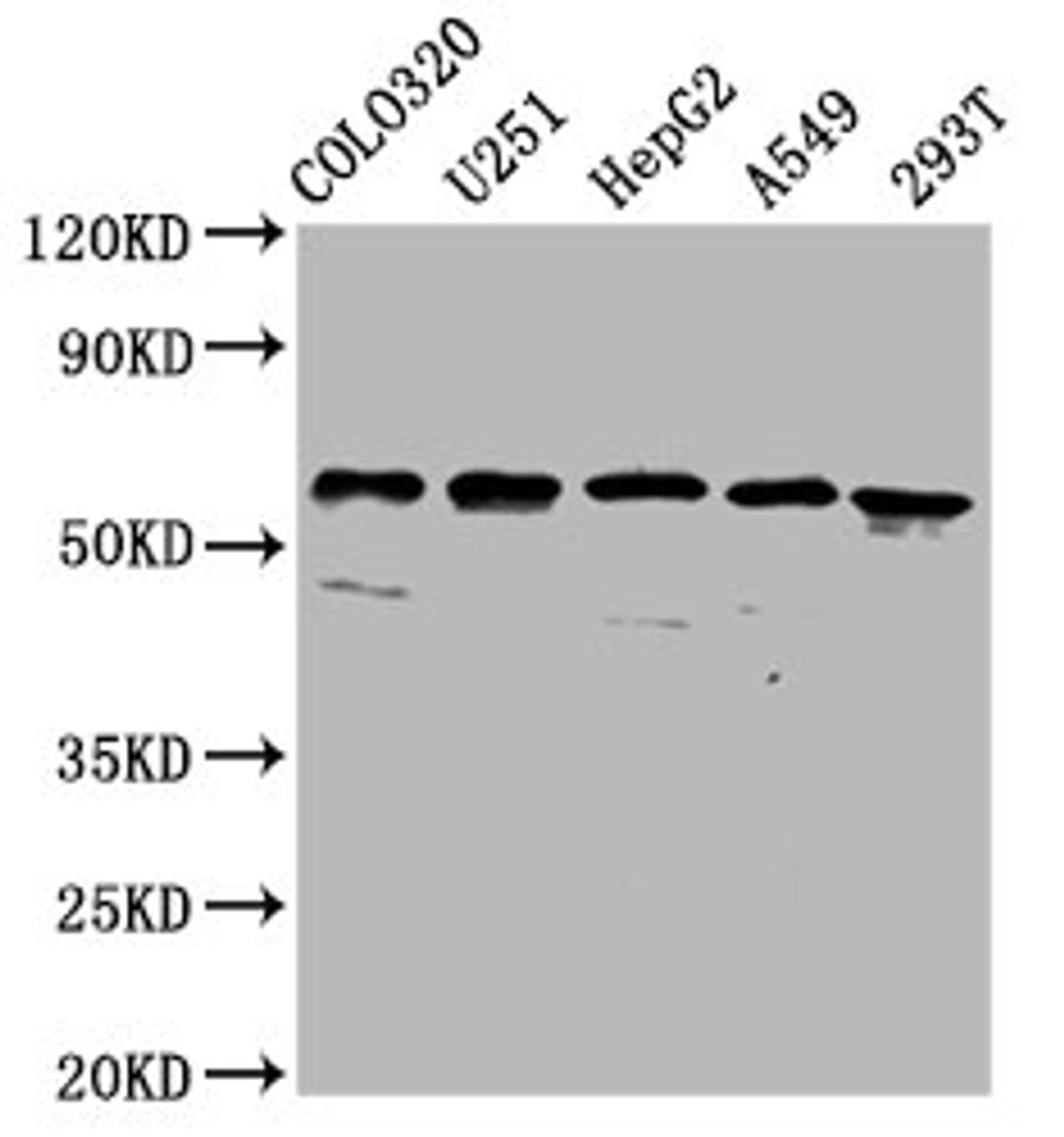 Western Blot. Positive WB detected in: Colo320 whole cell lysate, U251 whole cell lysate, HepG2 whole cell lysate, A549 whole cell lysate, 293T whole cell lysate. All lanes: CLCC1 antibody at 3.7µg/ml. Secondary. Goat polyclonal to rabbit IgG at 1/50000 dilution. Predicted band size: 63, 57, 48, 40 kDa. Observed band size: 63 kDa