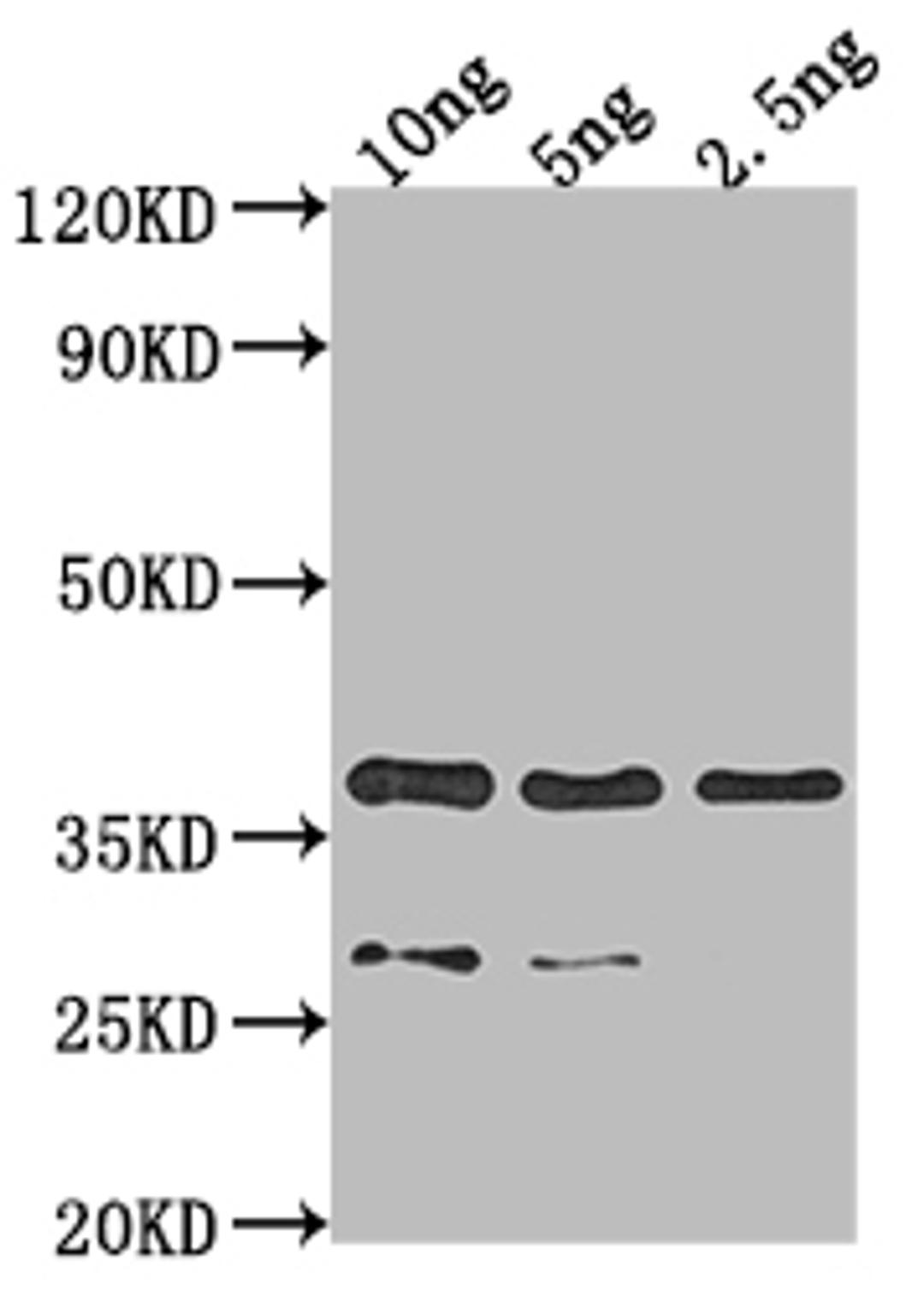 Western Blot. Positive WB detected in Recombinant protein. All lanes: VP39 antibody at 1:2000. Secondary. Goat polyclonal to rabbit IgG at 1/50000 dilution. Predicted band size: 35.5 kDa. Observed band size: 36 kDa. 