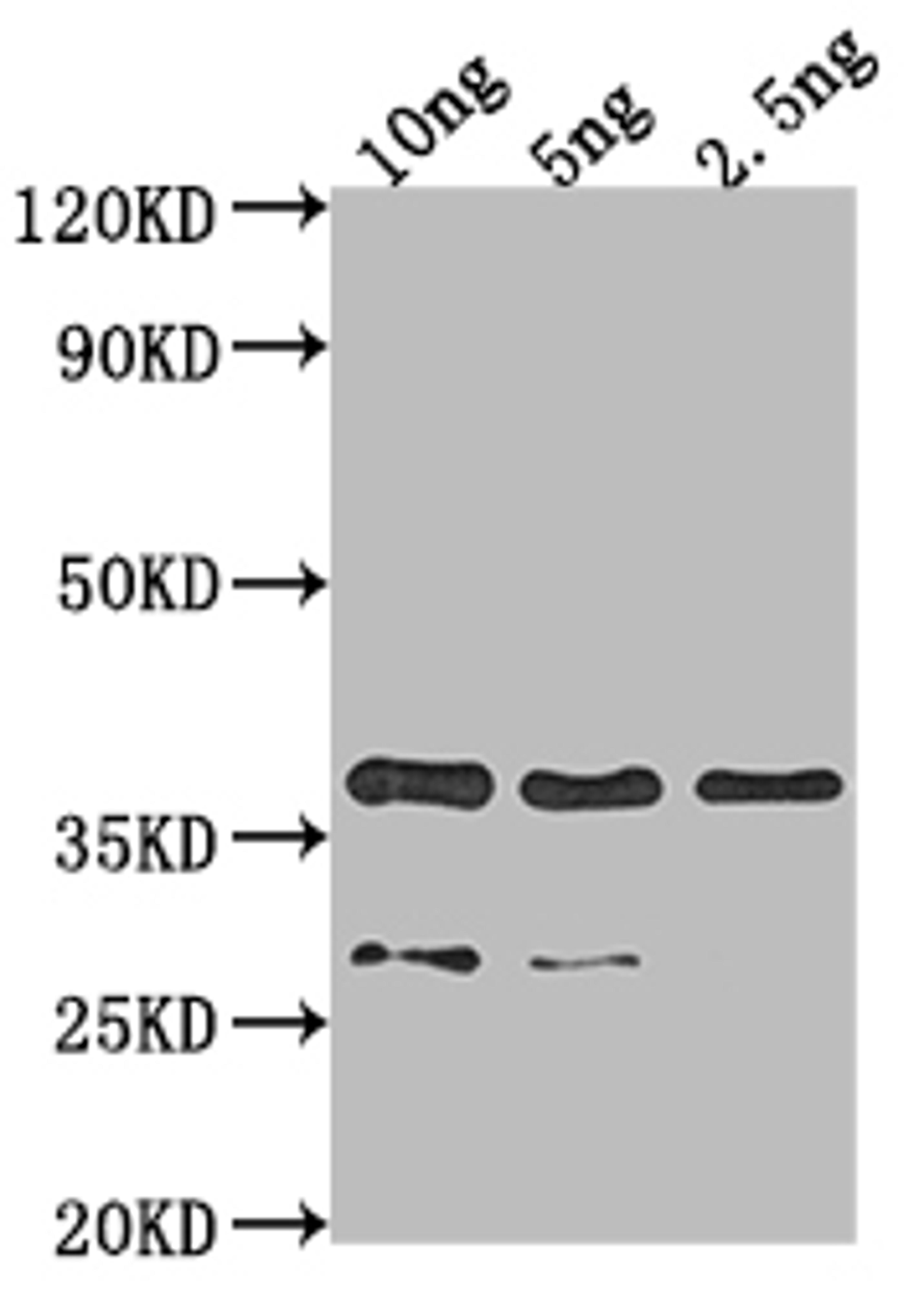 Western Blot. Positive WB detected in Recombinant protein. All lanes: VP39 antibody at 1:2000. Secondary. Goat polyclonal to rabbit IgG at 1/50000 dilution. Predicted band size: 35.5 kDa. Observed band size: 36 kDa.