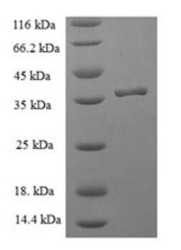 (Tris-Glycine gel) Discontinuous SDS-PAGE (reduced) with 5% enrichment gel and 15% separation gel.