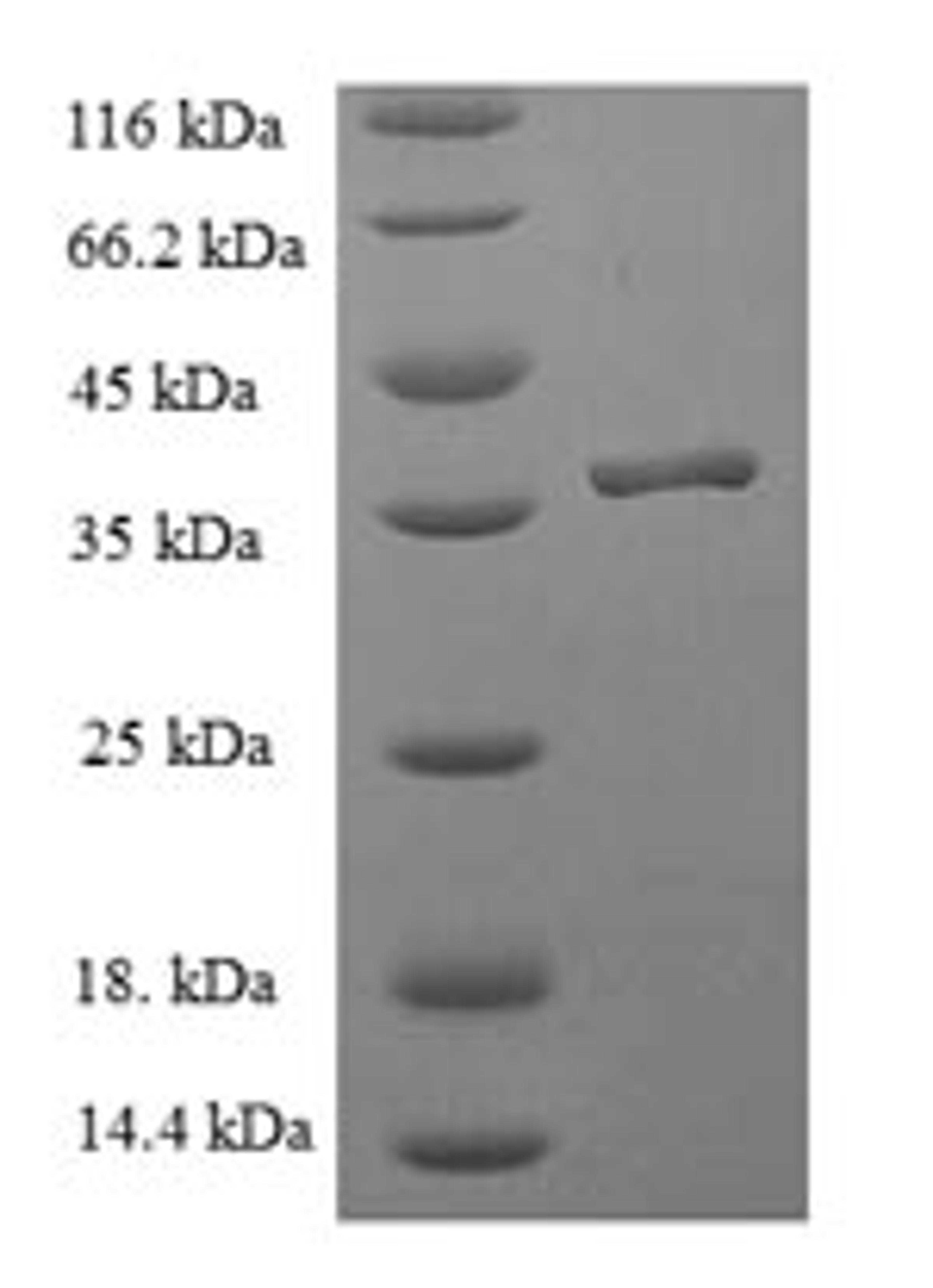 (Tris-Glycine gel) Discontinuous SDS-PAGE (reduced) with 5% enrichment gel and 15% separation gel.
