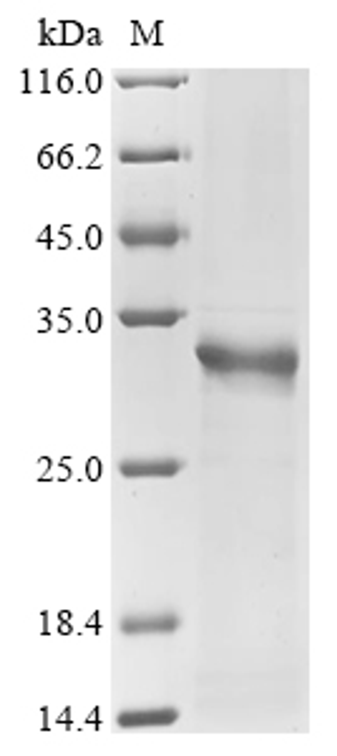 (Tris-Glycine gel) Discontinuous SDS-PAGE (reduced) with 5% enrichment gel and 15% separation gel.