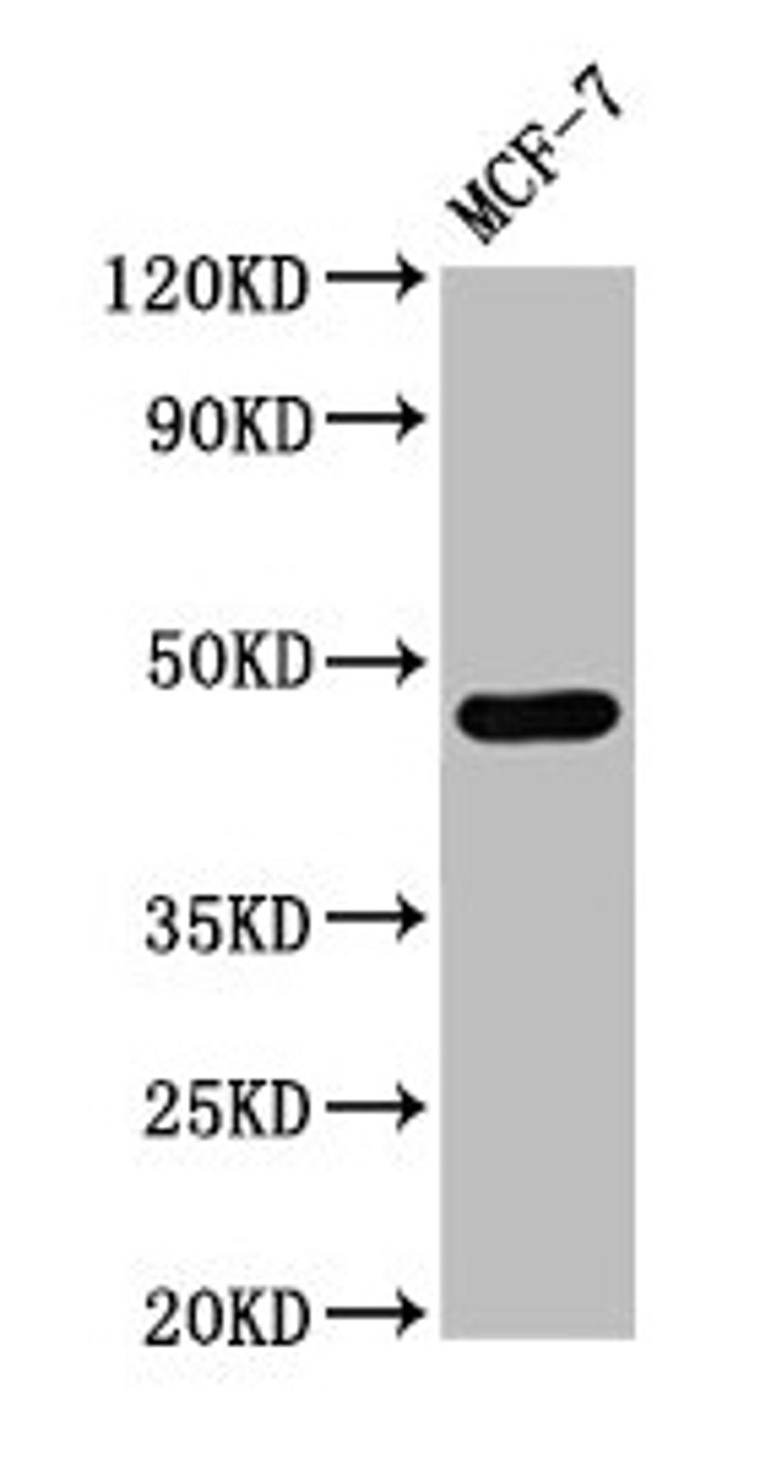 Western Blot. Positive WB detected in: MCF-7 whole cell lysate. All lanes: CASQ2 antibody at 3µg/ml. Secondary. Goat polyclonal to rabbit IgG at 1/50000 dilution. Predicted band size: 47, 39 kDa. Observed band size: 47 kDa