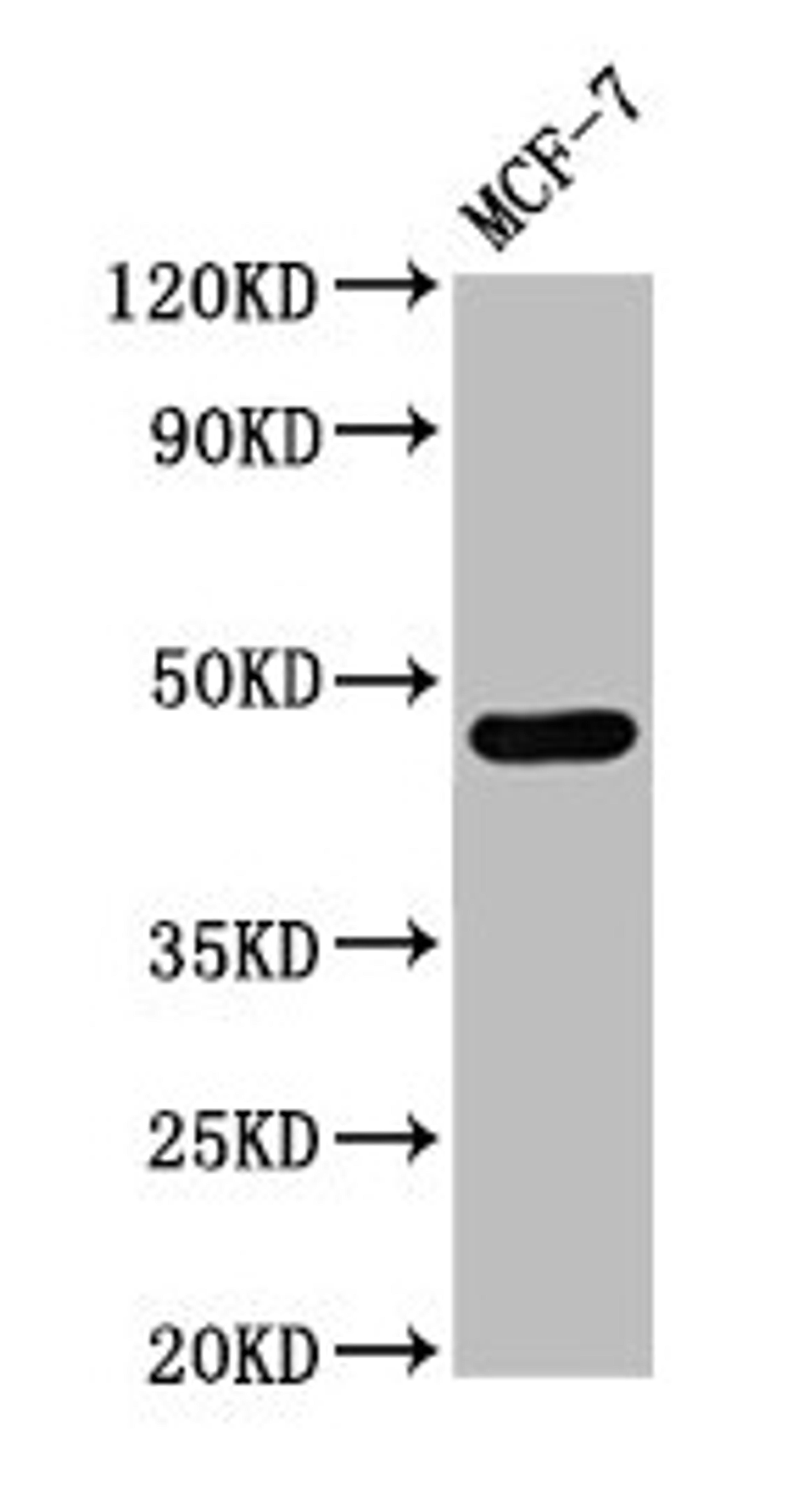 Western Blot. Positive WB detected in: MCF-7 whole cell lysate. All lanes: CASQ2 antibody at 3µg/ml. Secondary. Goat polyclonal to rabbit IgG at 1/50000 dilution. Predicted band size: 47, 39 kDa. Observed band size: 47 kDa