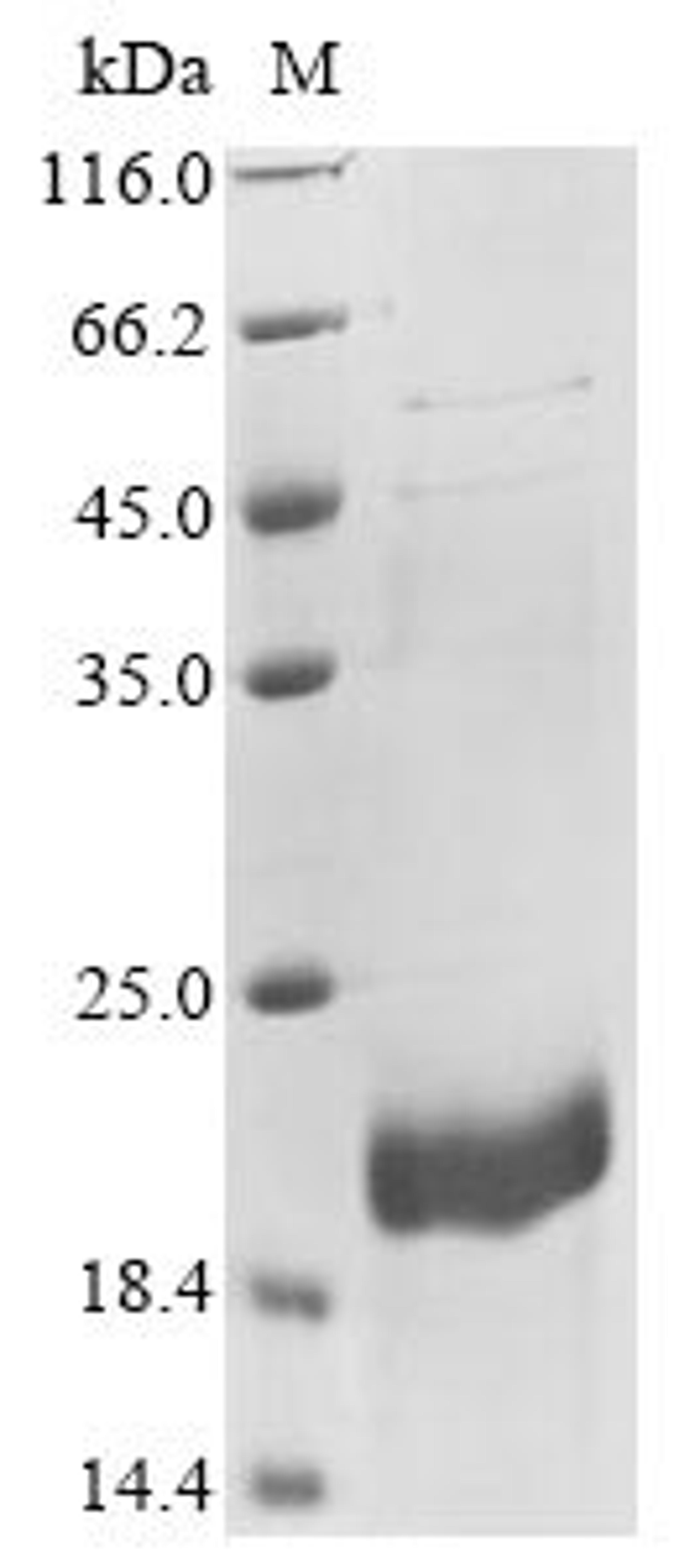 (Tris-Glycine gel) Discontinuous SDS-PAGE (reduced) with 5% enrichment gel and 15% separation gel.
