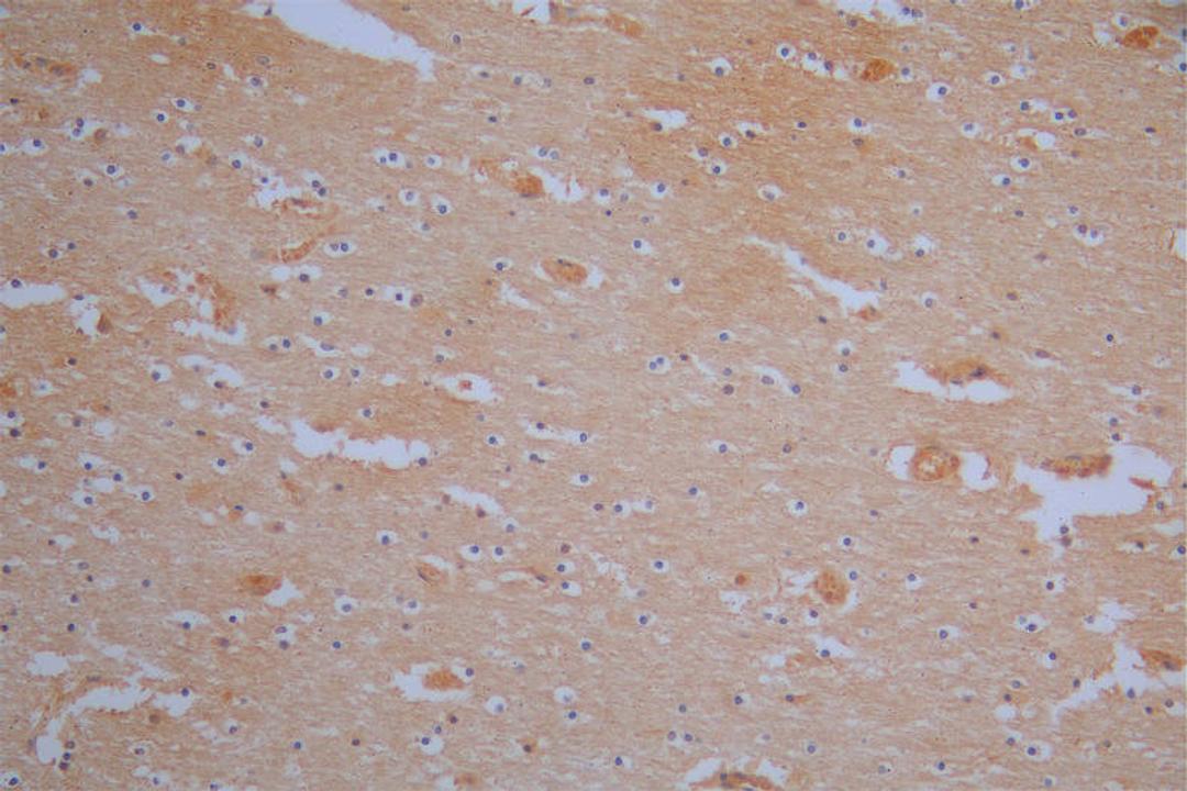 IHC image of CSB-RA619084MA1HU diluted at 1:200 and staining in paraffin-embedded human brain tissue performed on a Leica BondTM system. After dewaxing and hydration,  antigen retrieval was mediated by high pressure in a citrate buffer (pH 6.0). Section was blocked with 10% normal goat serum 30min at RT. Then primary antibody (1% BSA) was incubated at 4°C overnight. The primary is detected by a Goat anti-Mouse IgG labeled by HRP and visualized using 0.05% DAB.