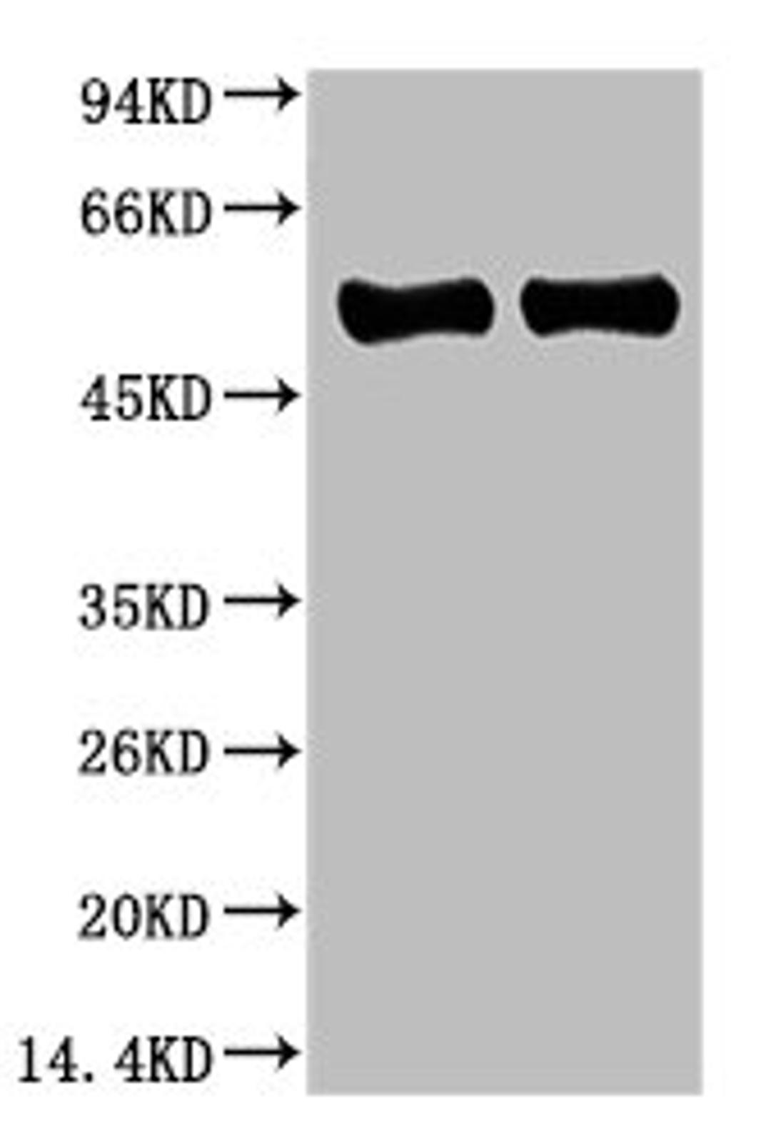 Western blot analysis of Arabidopsis with Rubisco(Large Chain) Mouse mAb diluted at 1)1:2,000；2)1:5,000
