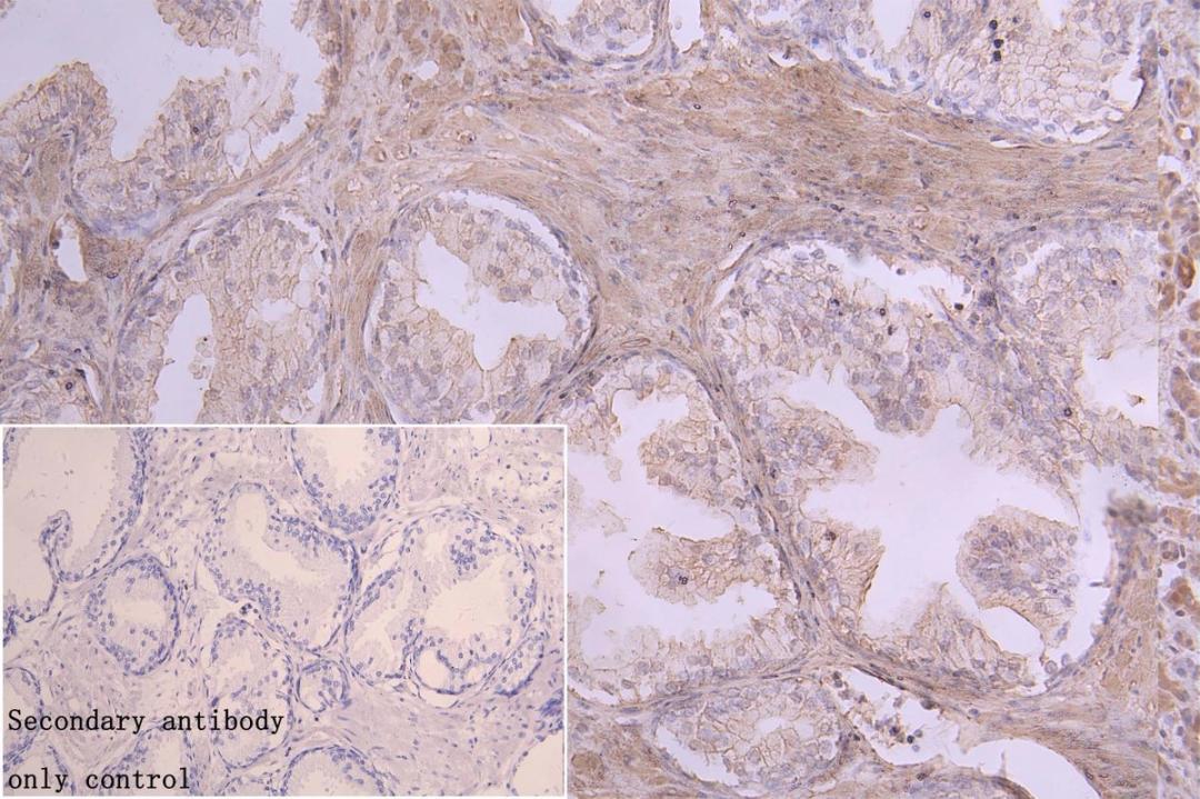Immunohistochemistry of paraffin-embedded human brain tissue using CSB-PA002422LA01HU at dilution of 1:100