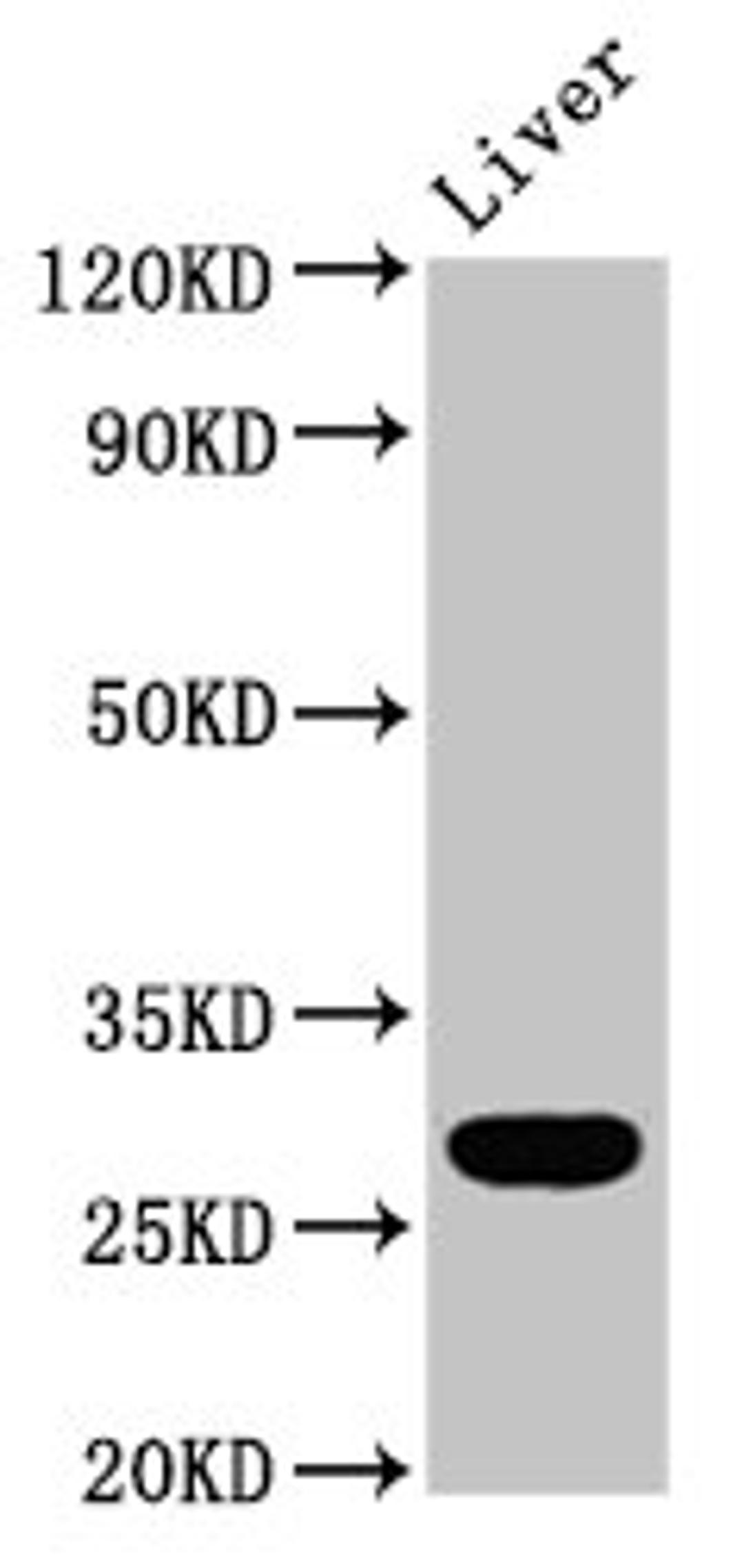 Western Blot. Positive WB detected in: Rat liver tissue. All lanes: RAB26 antibody at 5.9ug/ml. Secondary. Goat polyclonal to rabbit IgG at 1/50000 dilution. Predicted band size: 28, 22 kDa. Observed band size: 28 kDa. 