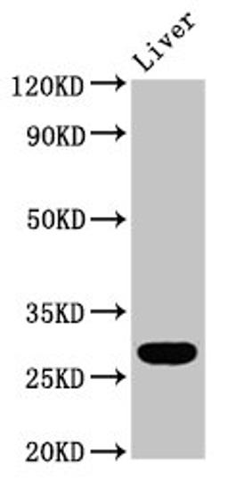 Western Blot. Positive WB detected in: Rat liver tissue. All lanes: RAB26 antibody at 5.9ug/ml. Secondary. Goat polyclonal to rabbit IgG at 1/50000 dilution. Predicted band size: 28, 22 kDa. Observed band size: 28 kDa. 