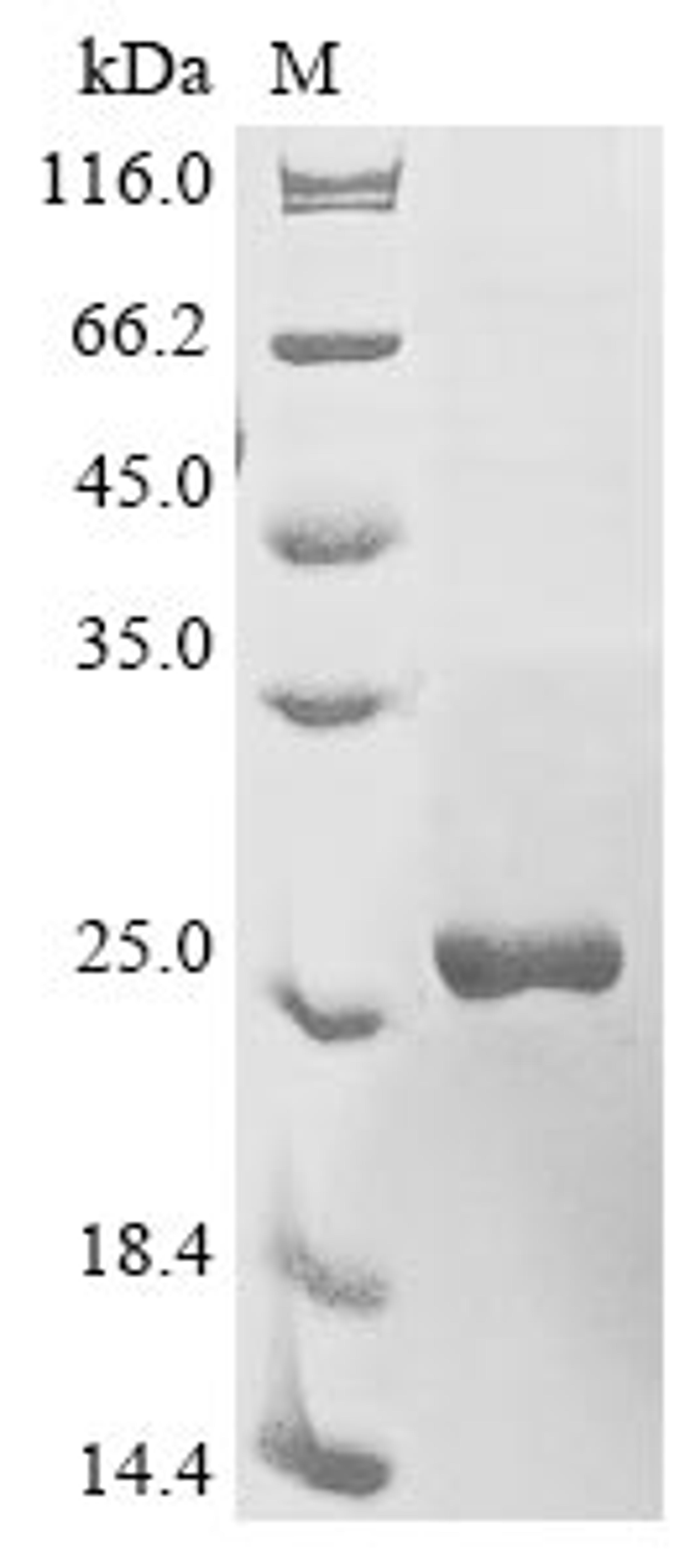 (Tris-Glycine gel) Discontinuous SDS-PAGE (reduced) with 5% enrichment gel and 15% separation gel.