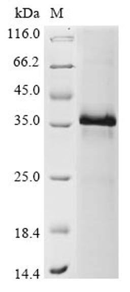 (Tris-Glycine gel) Discontinuous SDS-PAGE (reduced) with 5% enrichment gel and 15% separation gel.