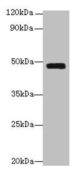 Western blot. All lanes: Serpinh1 antibody at 6µg/ml + Jurkat whole cell lysate. Secondary. Goat polyclonal to rabbit IgG at 1/10000 dilution. Predicted band size: 47 kDa. Observed band size: 47 kDa