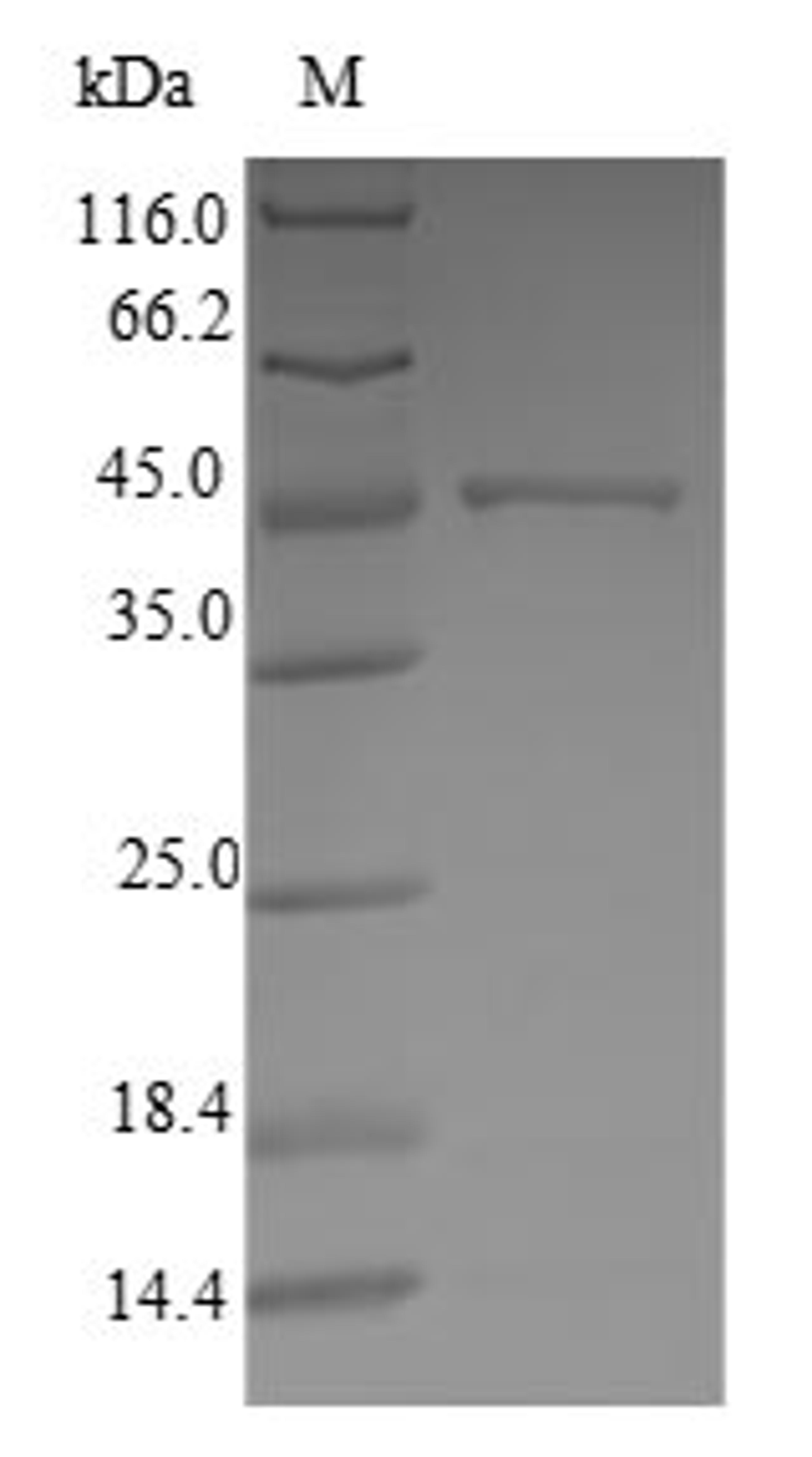 (Tris-Glycine gel) Discontinuous SDS-PAGE (reduced) with 5% enrichment gel and 15% separation gel.