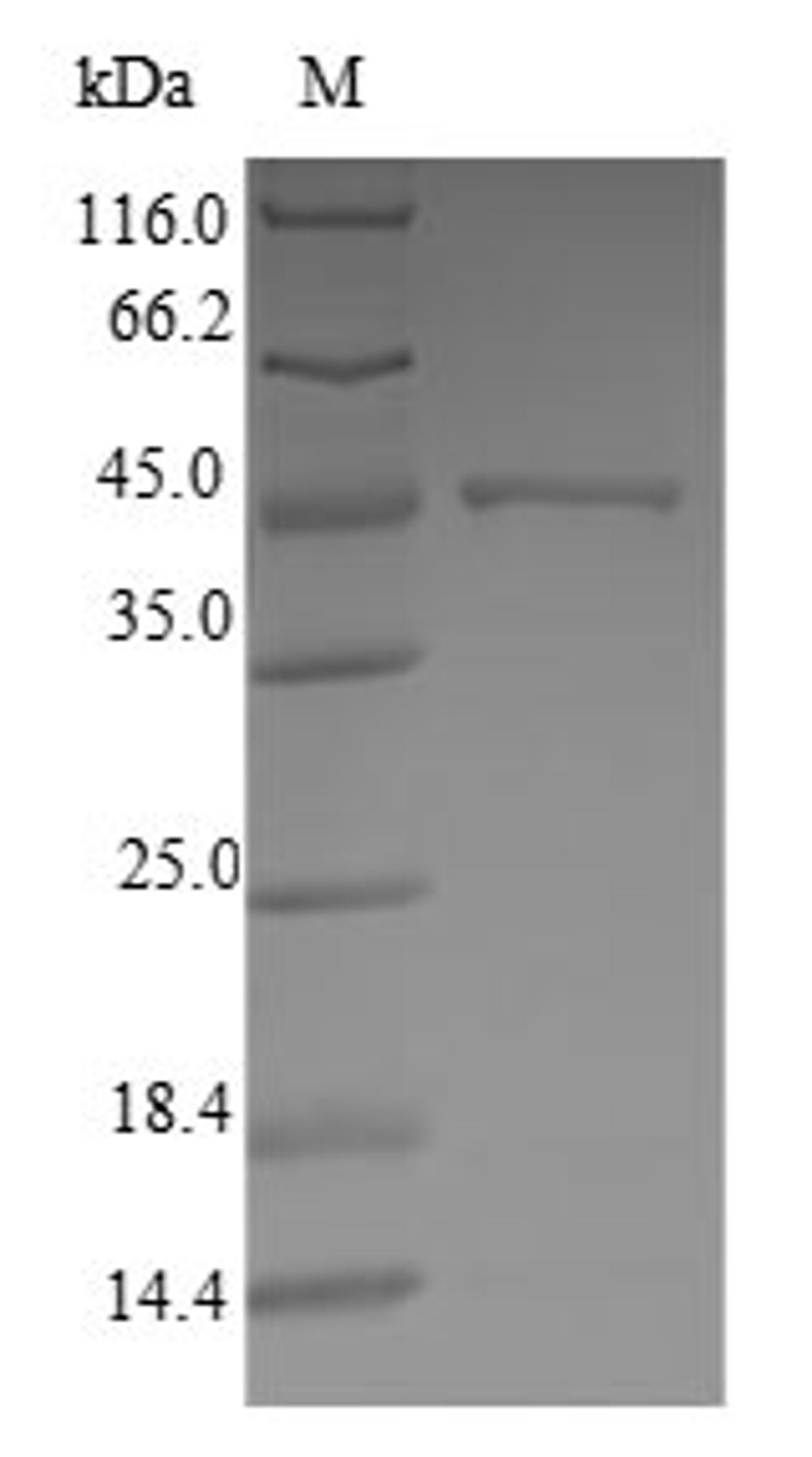 (Tris-Glycine gel) Discontinuous SDS-PAGE (reduced) with 5% enrichment gel and 15% separation gel.