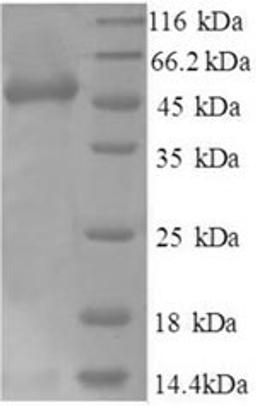 (Tris-Glycine gel) Discontinuous SDS-PAGE (reduced) with 5% enrichment gel and 15% separation gel.