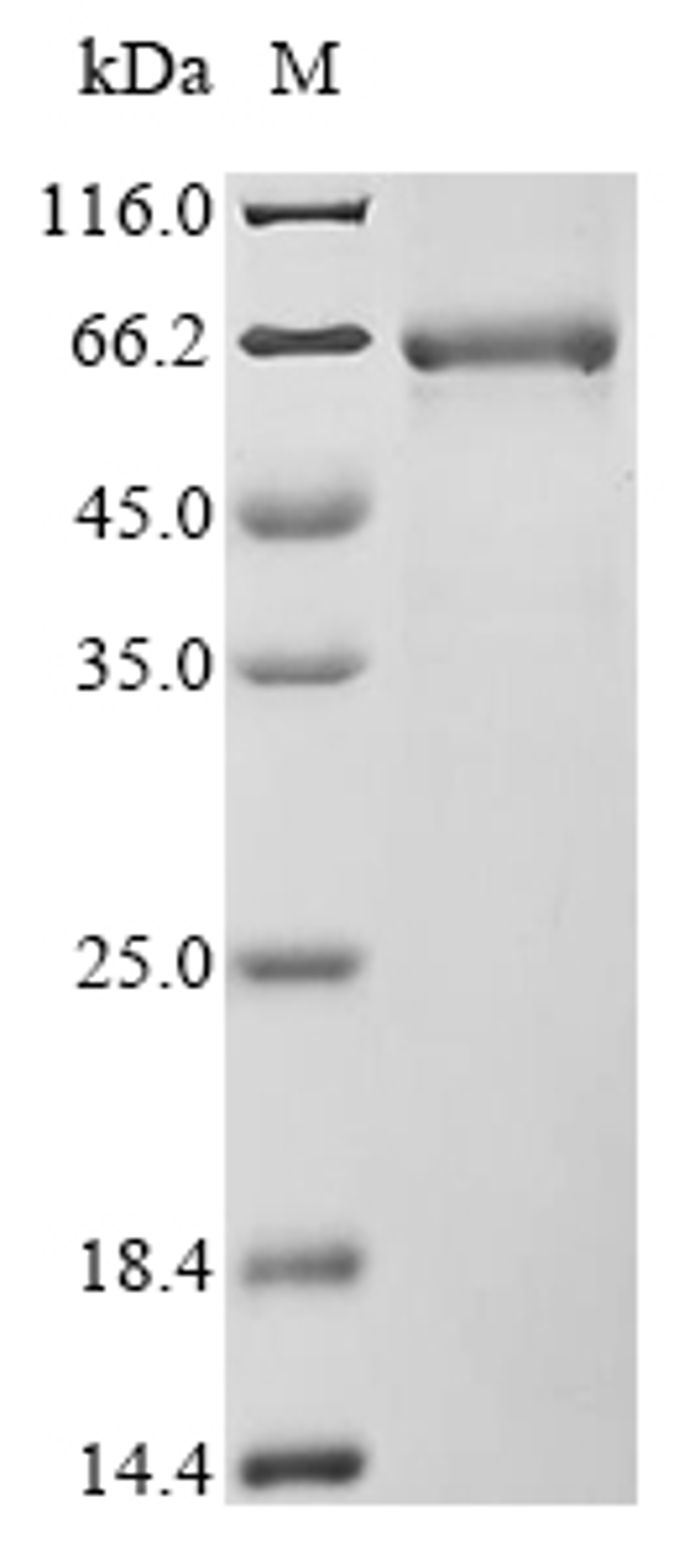 (Tris-Glycine gel) Discontinuous SDS-PAGE (reduced) with 5% enrichment gel and 15% separation gel.